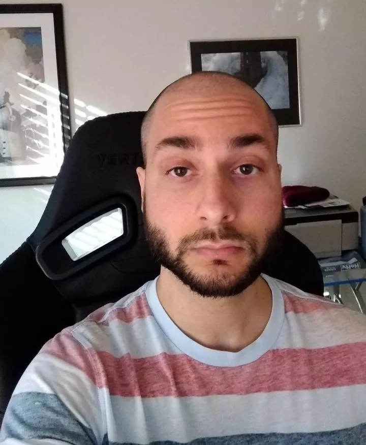 Happy Easter! I shaved my head for the first time, what do you think? posted by Cody11199