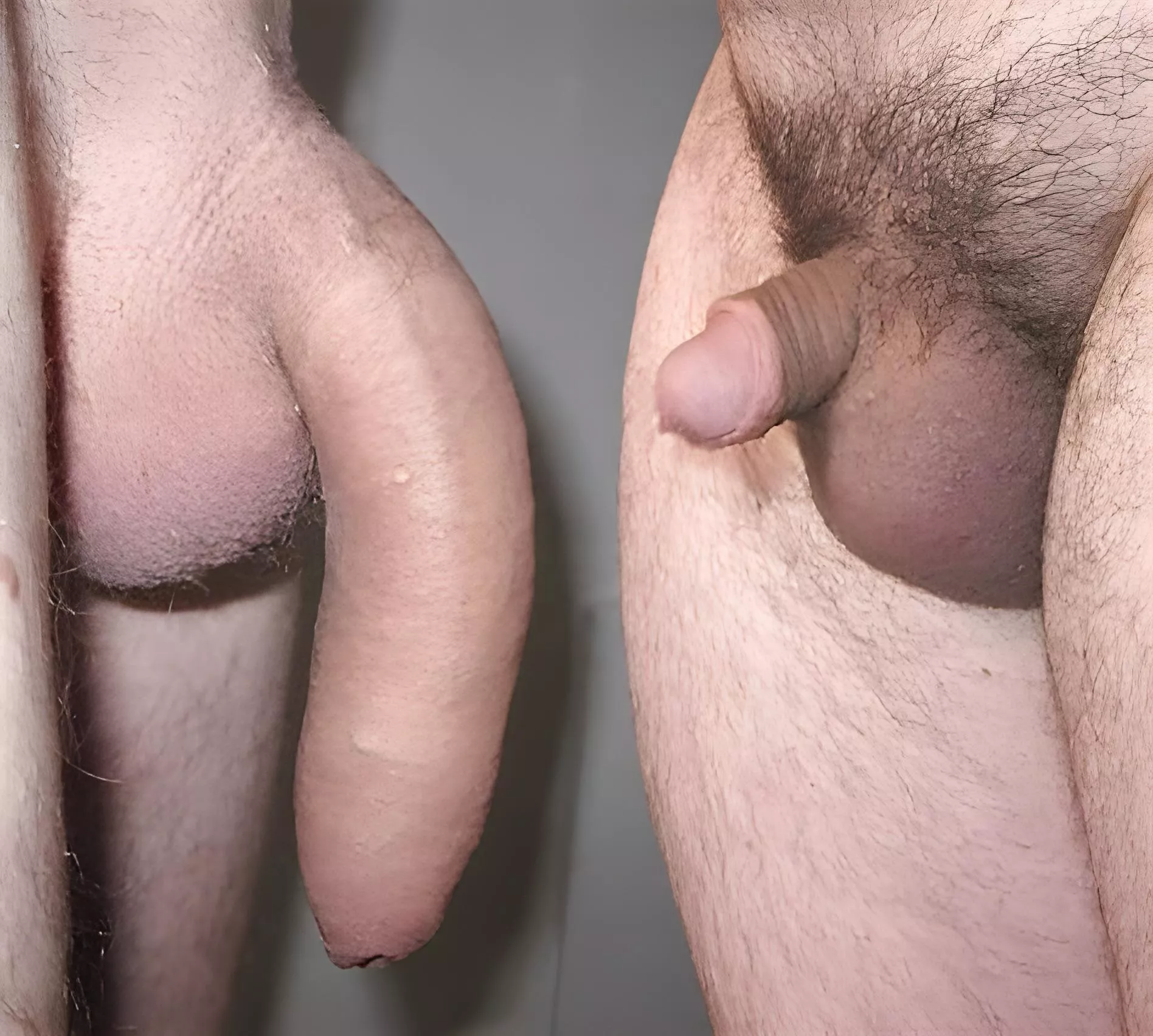 Hung softie vs small hard posted by Desperate_Ad7592