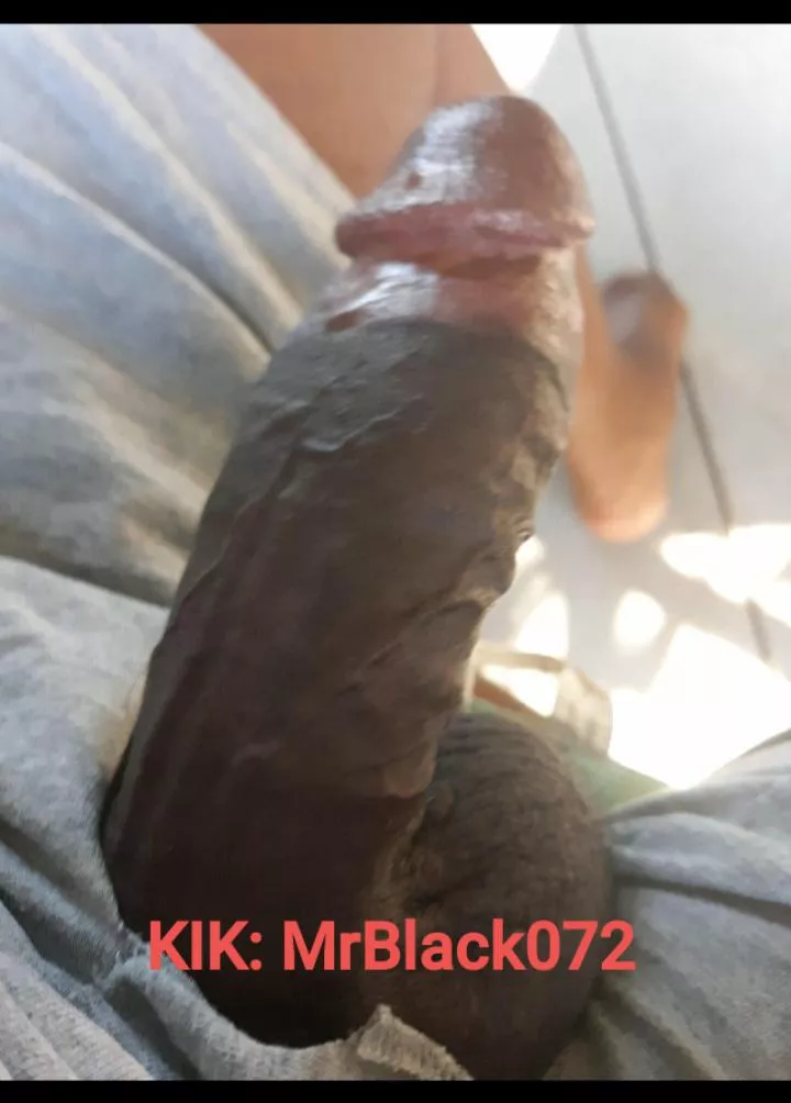 Want someone to kiss it .... posted by MrBlack72