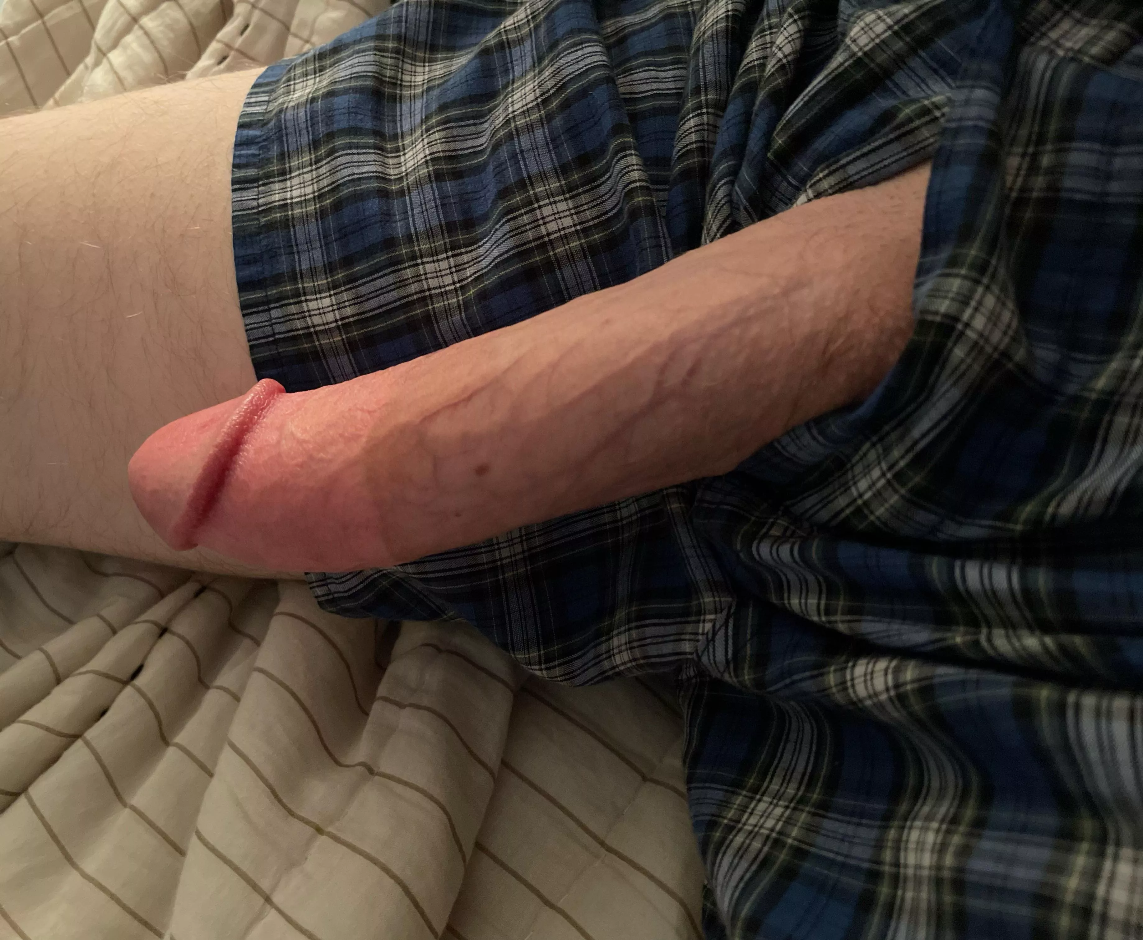 What would you like to do with my third leg? posted by SOLAT6isBack