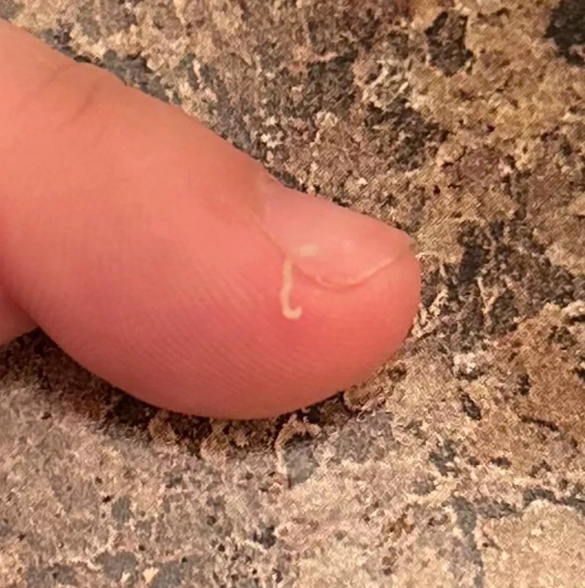 Popped this out of my chin just now posted by SlavicMans16