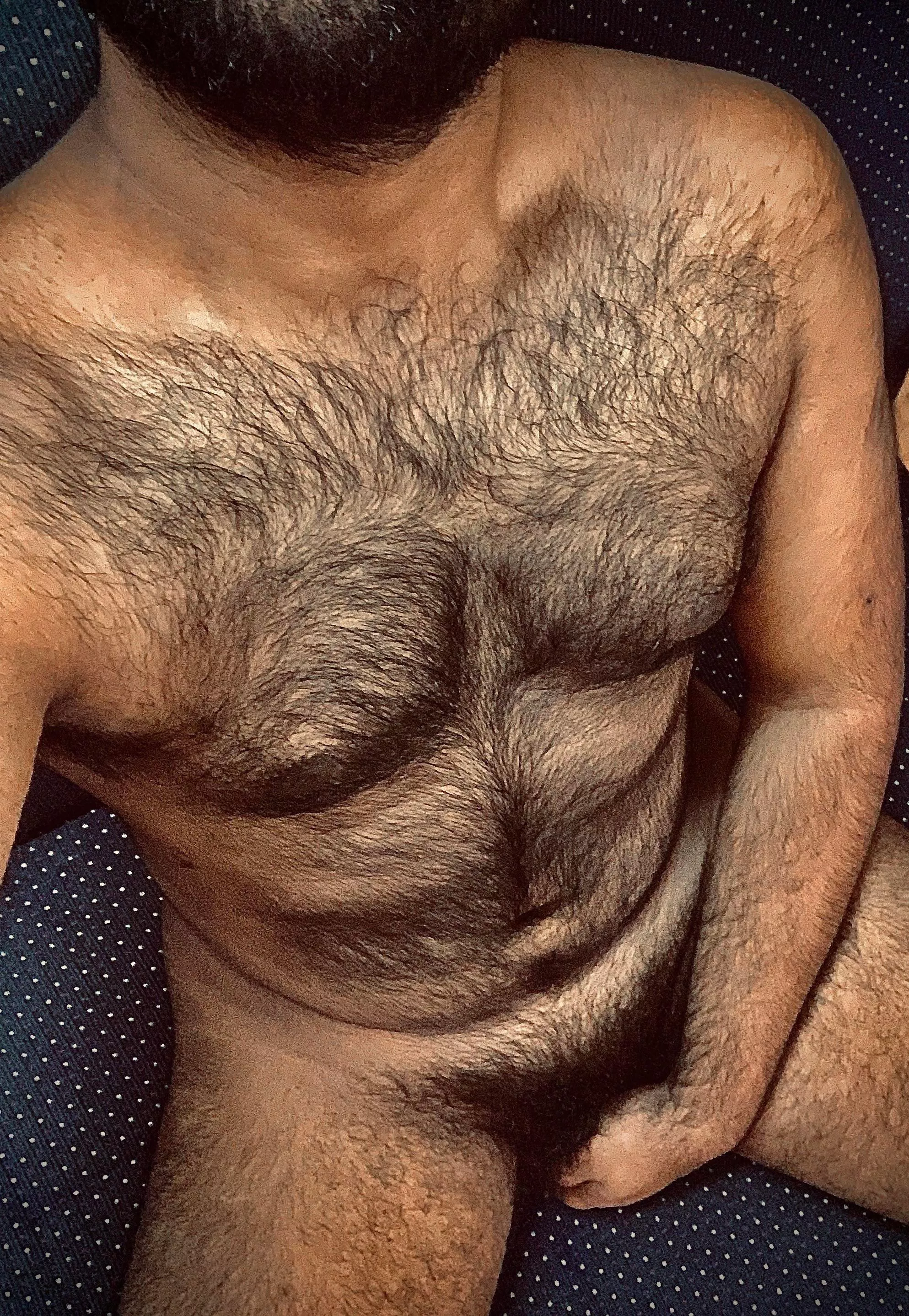 25m 6ft How much hairy is too much hairy? :( posted by myname_not_important