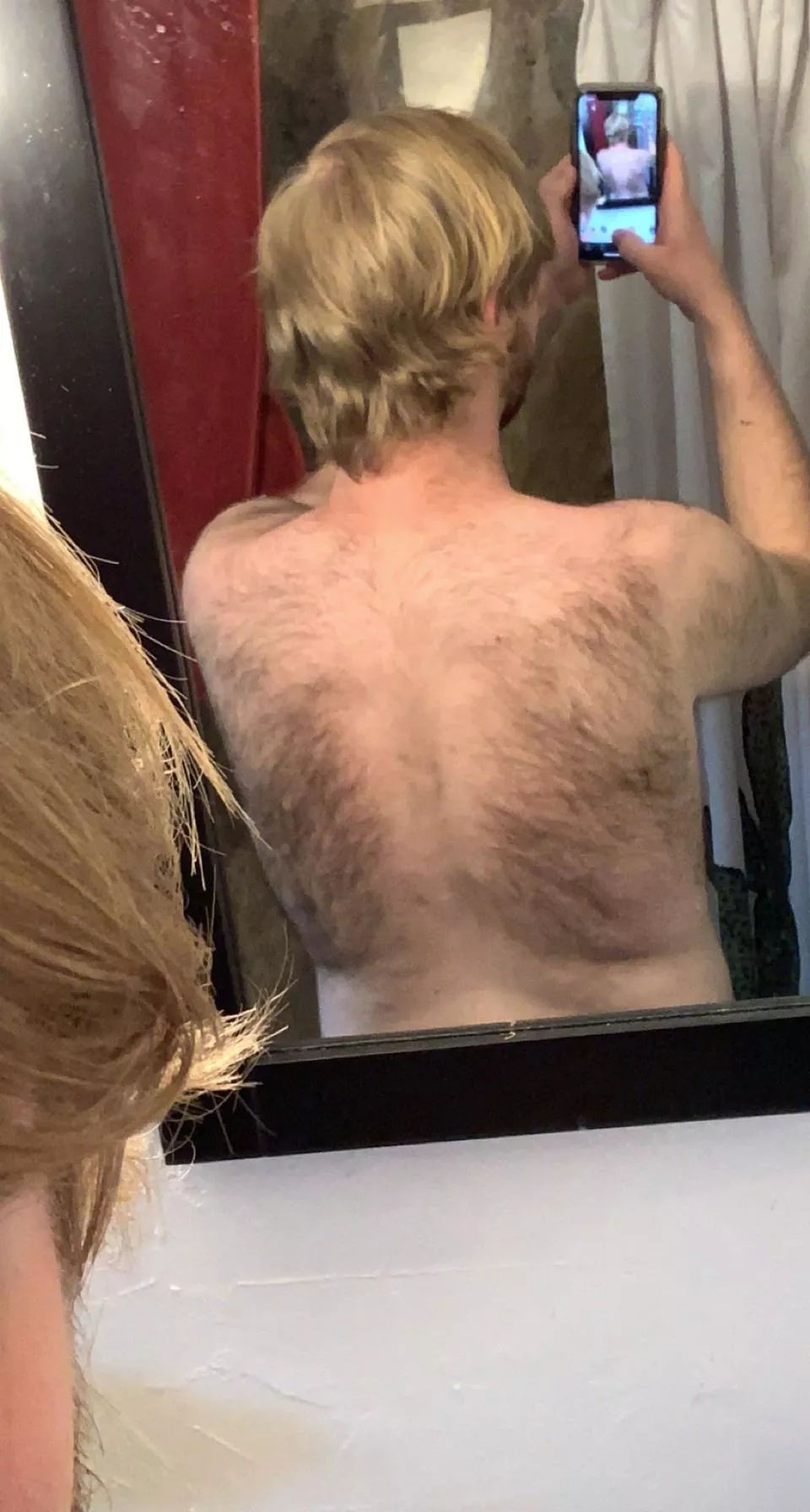 A part 2 of my last post: back hair update posted by Tall-Face-3998