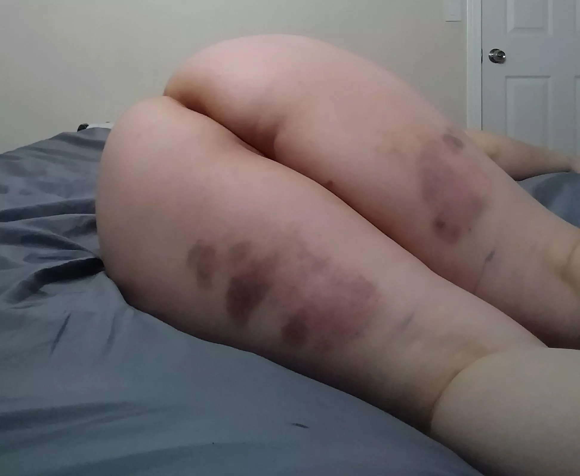 After I was fucked and beaten ðŸ’œ [NB] posted by FreeUseFelicia