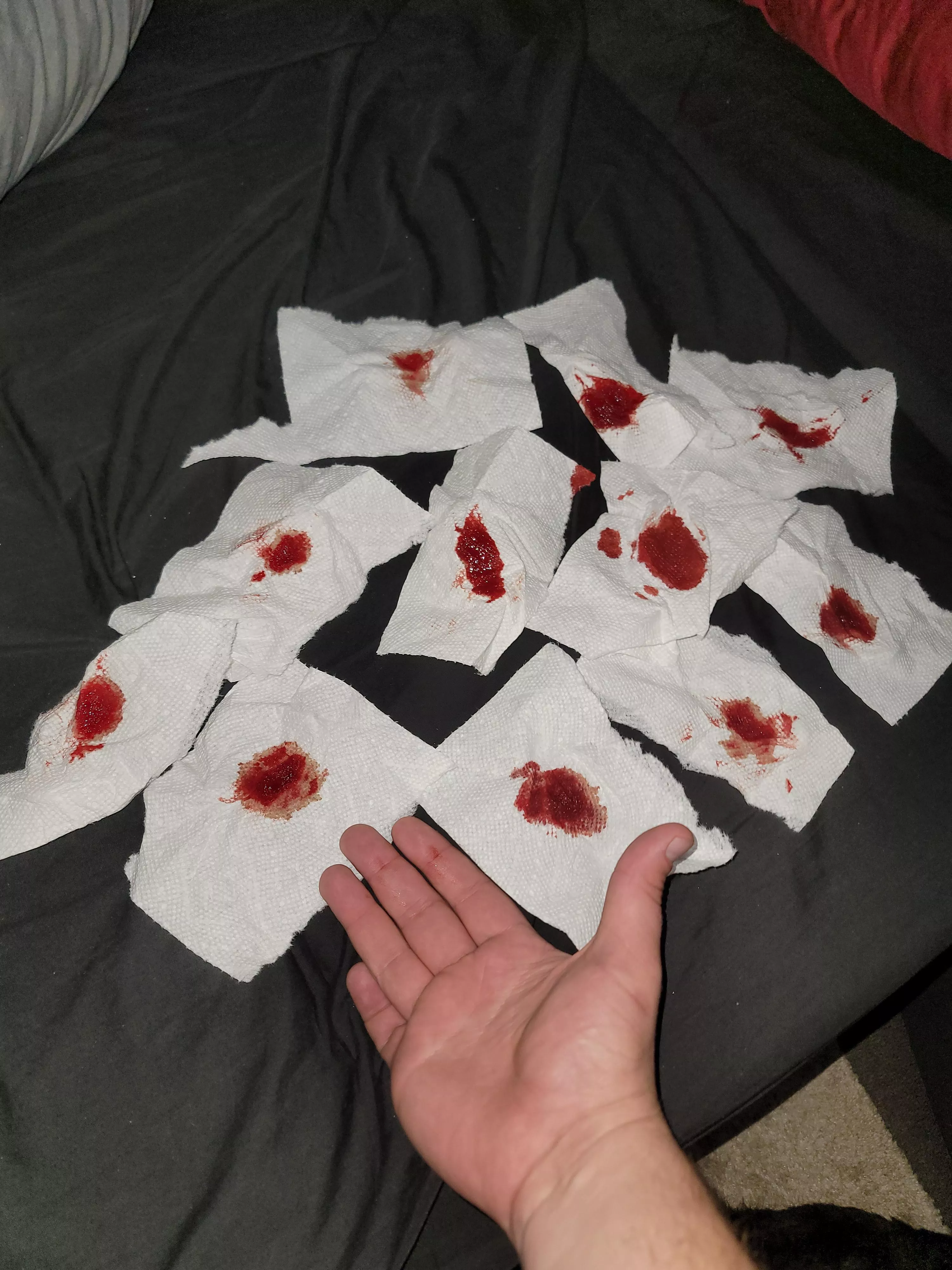 All the blood from a cyst on my ass. It popped a couple weeks ago too and the blood was running down my leg and dripping on the floor. I've never seen so much blood come out of me. Hand for scale posted by analscreams