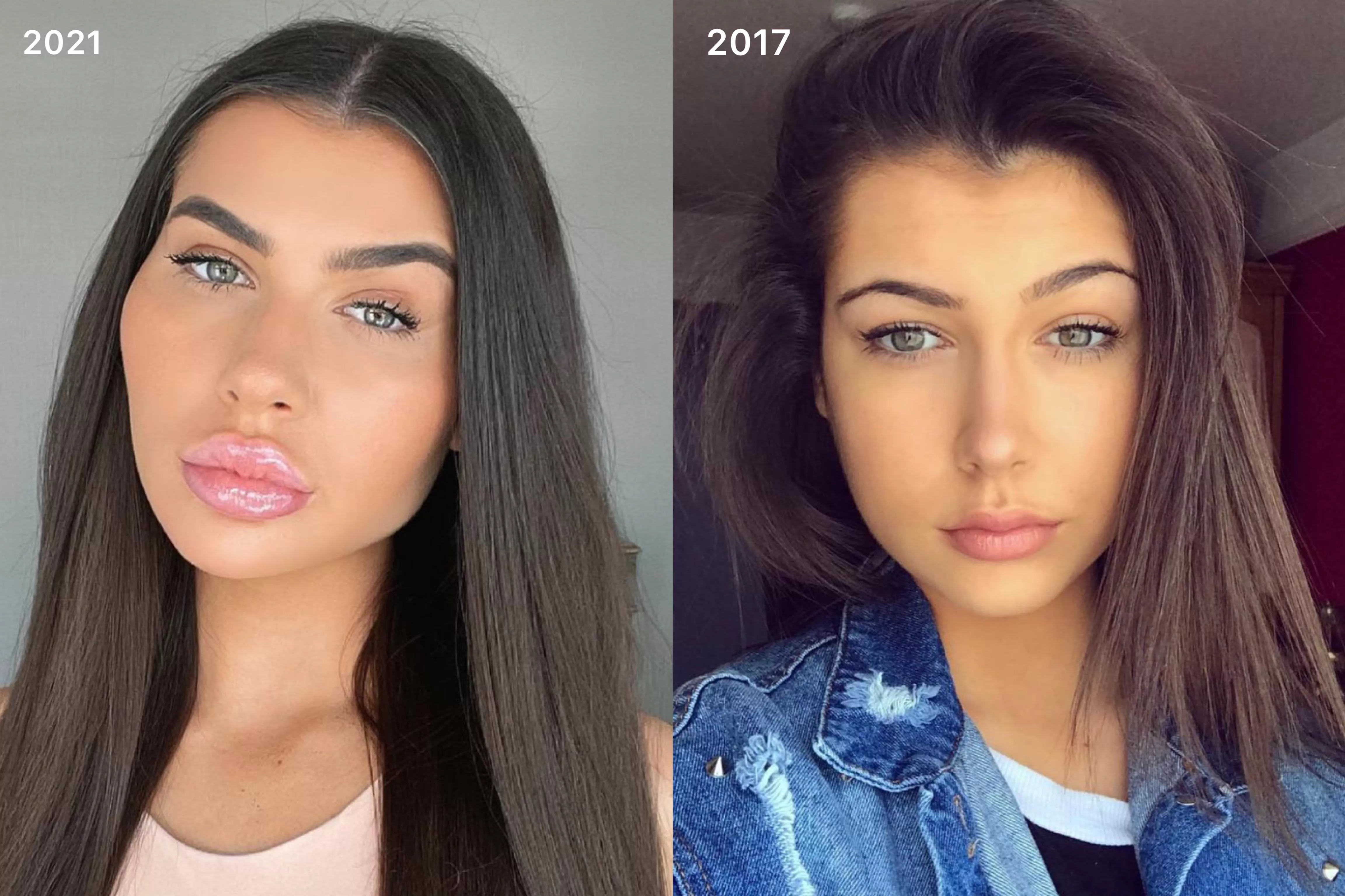 Amazing transformation! posted by lipaddictz