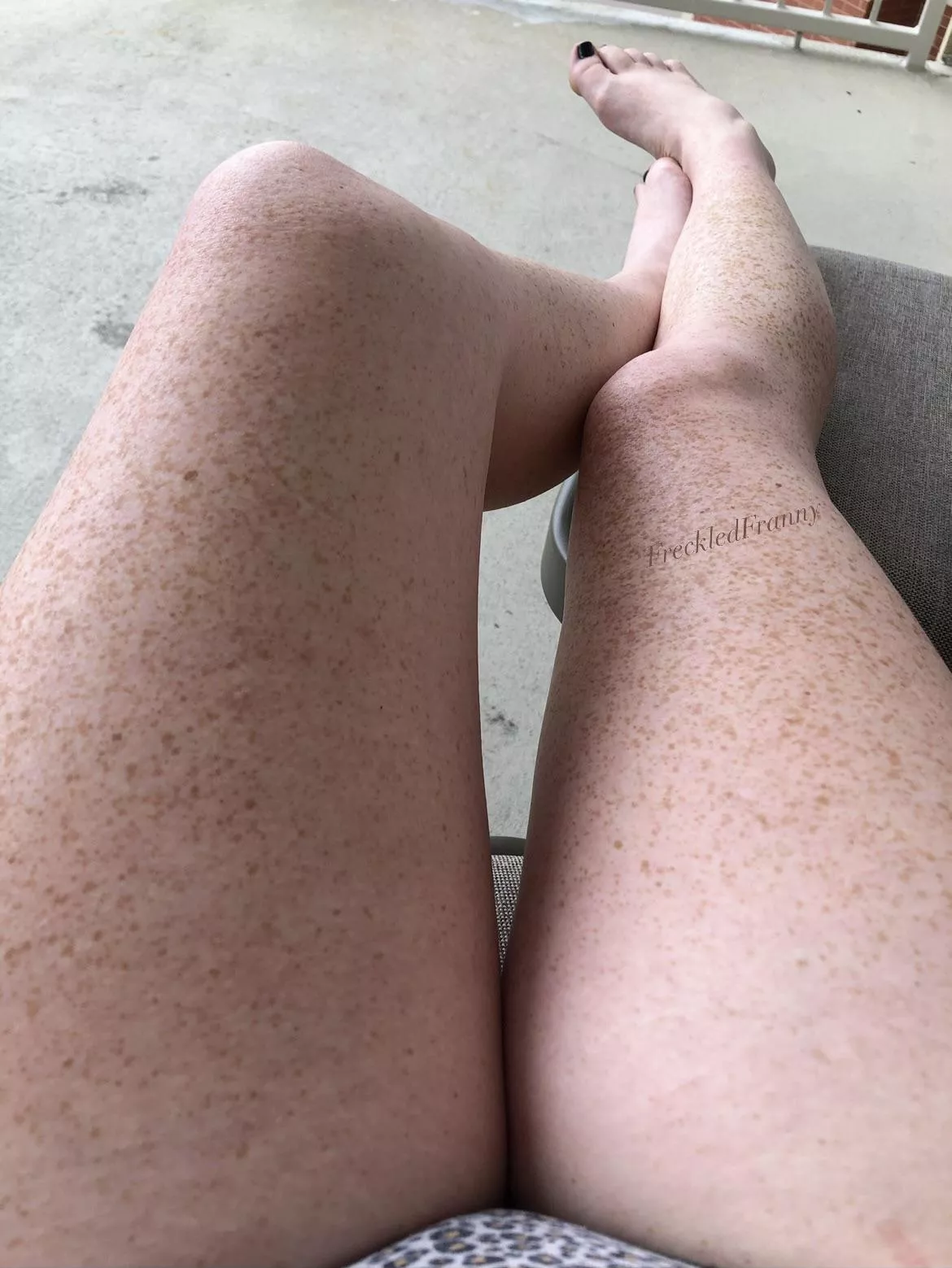 Anyone like my freckled legs? posted by FreckledFranny