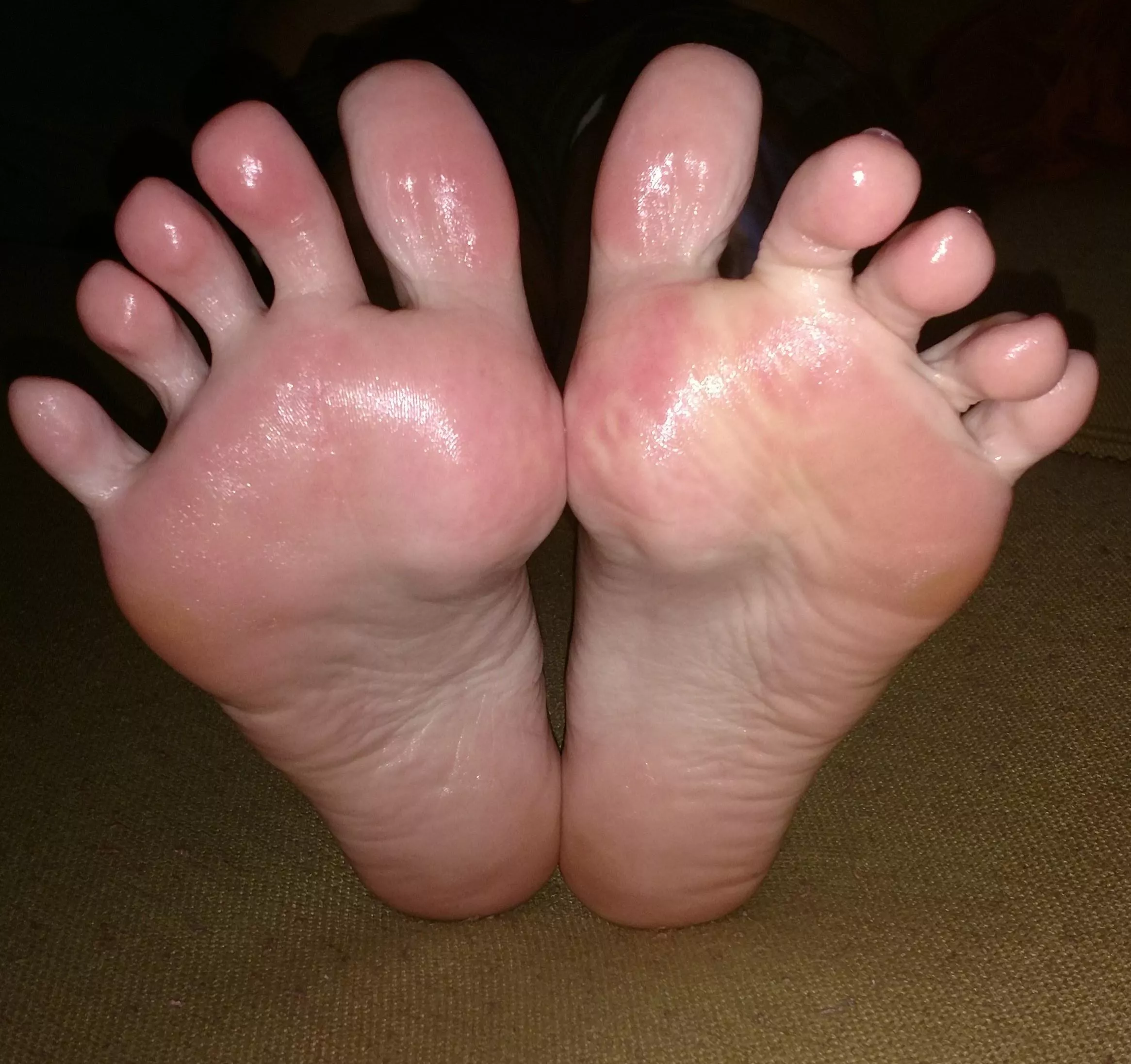 Anyone want to help me moisturize my soles? posted by ZazzyZebra