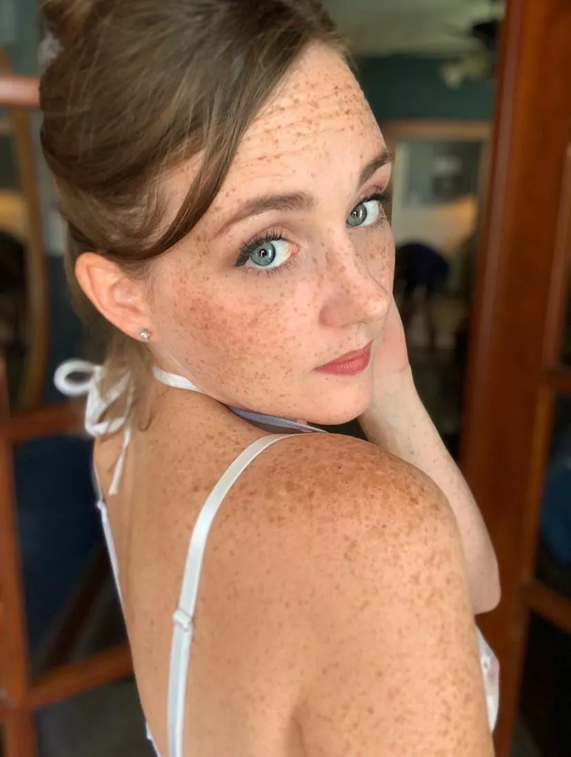 Back freckles 😍 posted by Rarity_bee