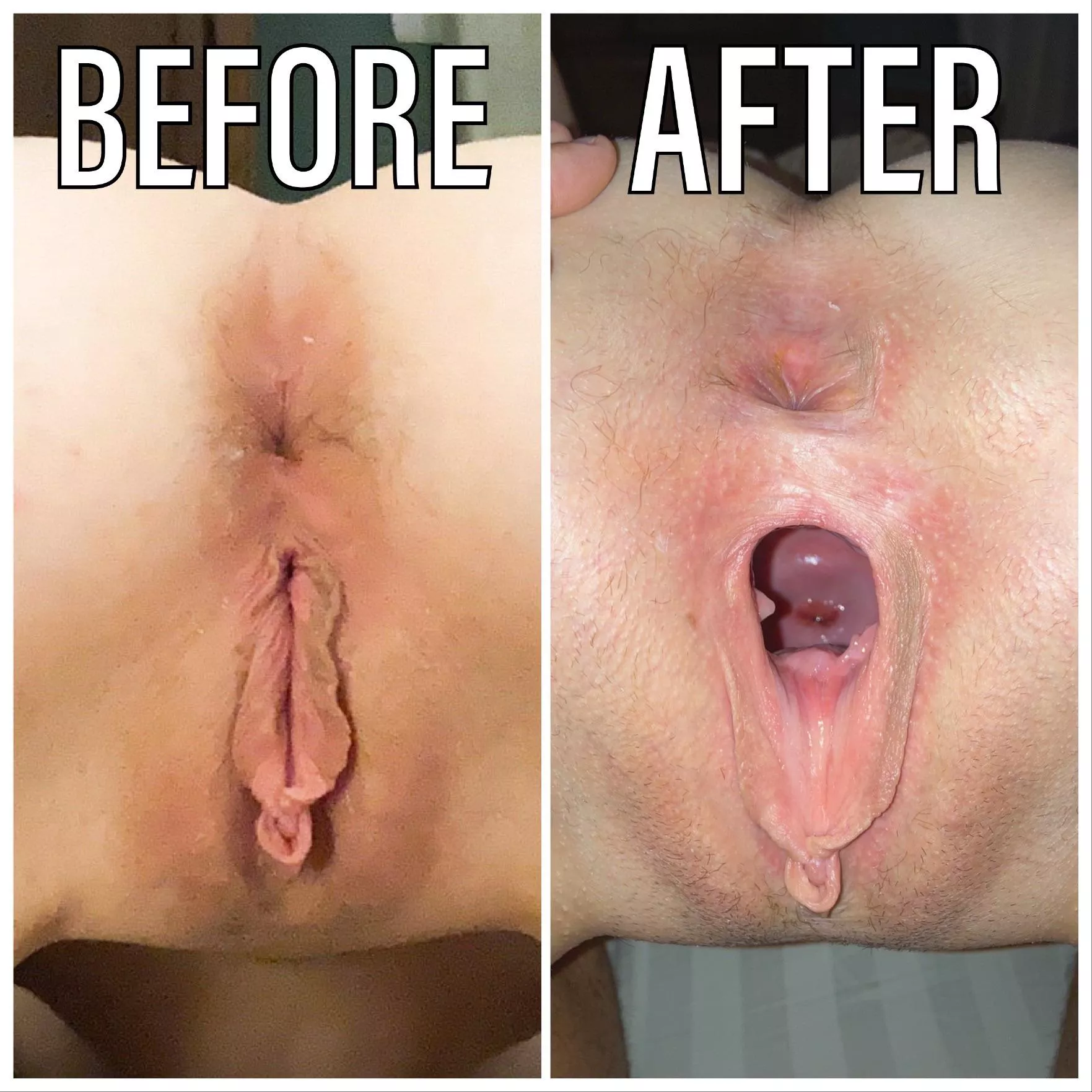 Beautiful before/after shot of one of my favorite sluts after my big thick cock put some seriously mileage on her hole. Check out that cervix shot. Show her ruined pussy some upvote/comment love. posted by roper44