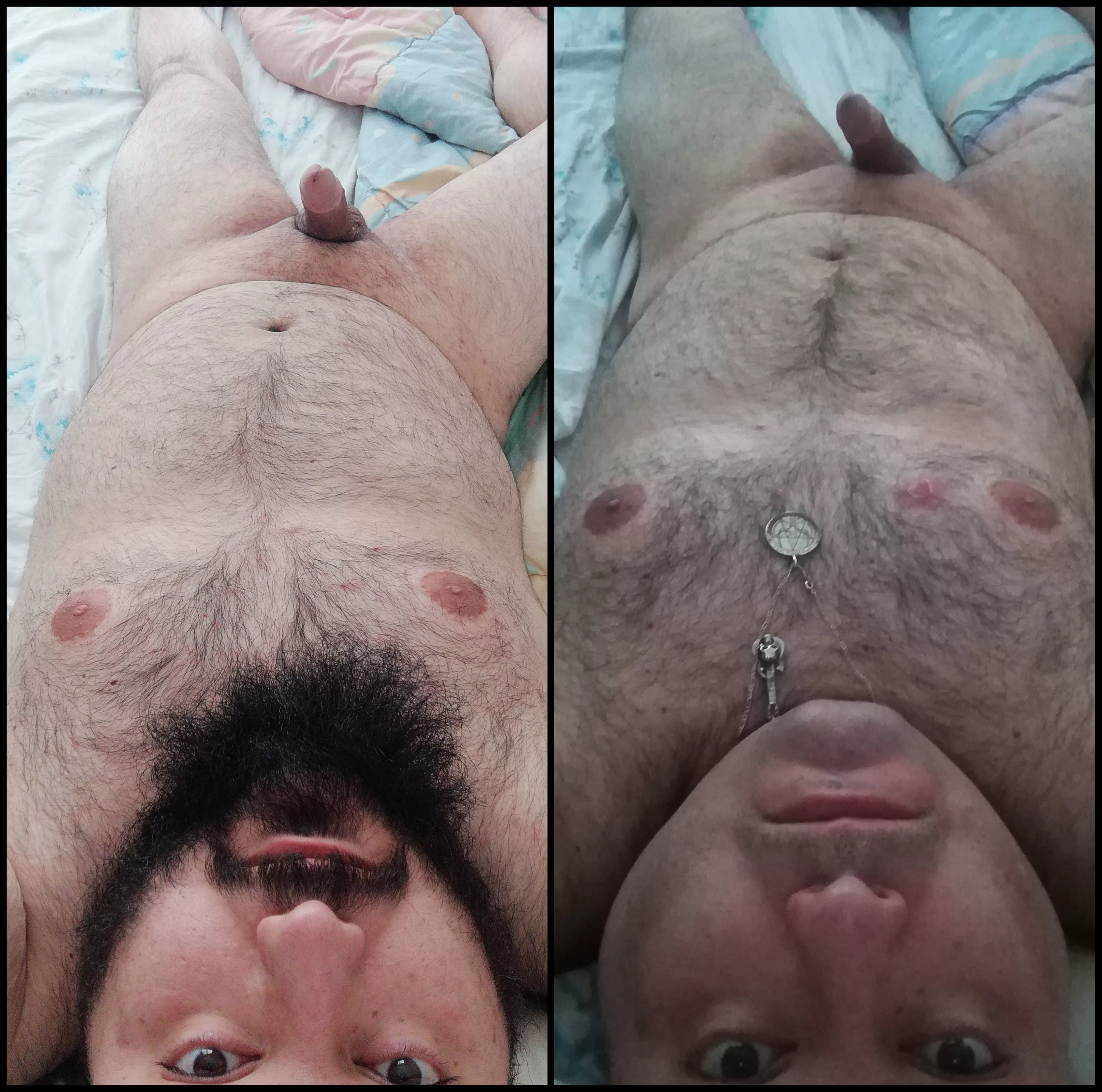 Before and after / I lost my beard to a shaving accident. posted by weirdsex1