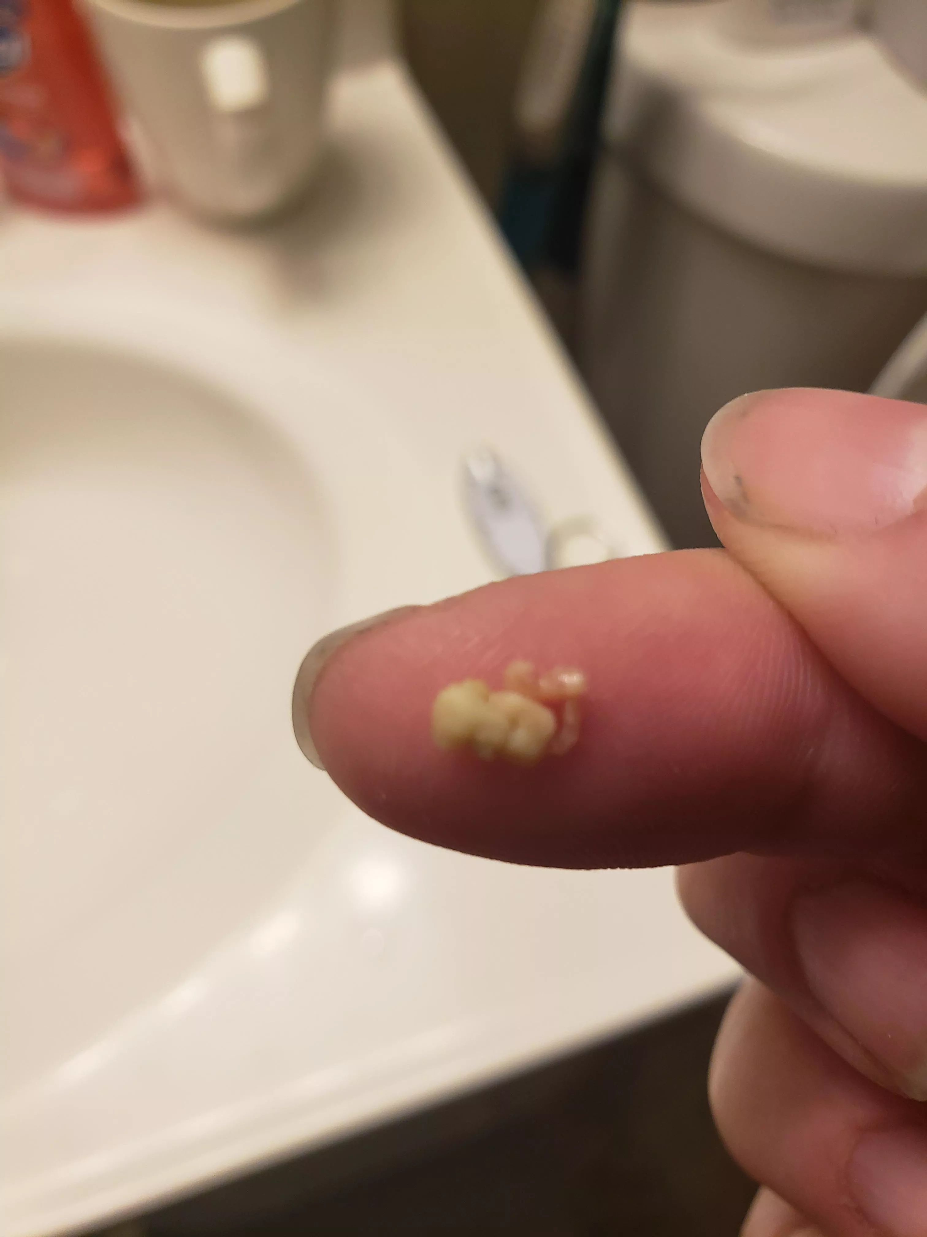 Before this sub I didn't even know tonsil stones were a thing..today, I pulled this out. posted by l4rest15