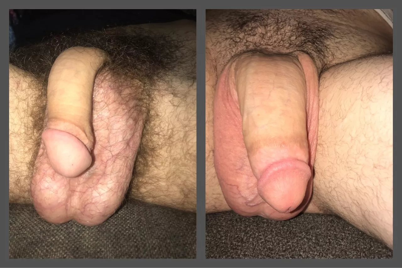 bestfriend (left) and I (right) wanted to soft compare, which do you prefer? posted by RUOFFOUR