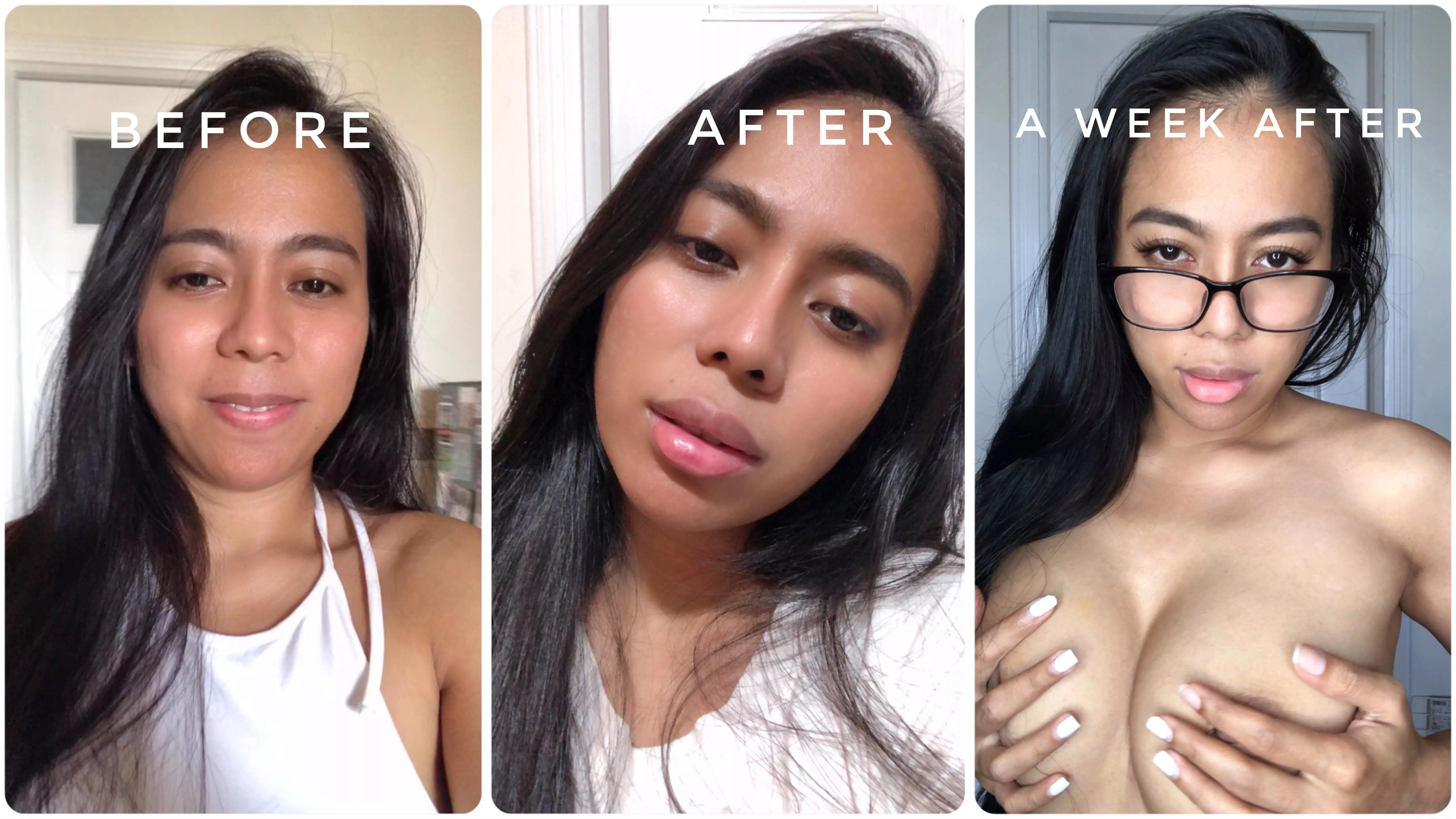 Bimbo journey update: A generous supporter funded my first ever round of lip fillers! Iâ€™m sooo over the moon!! ðŸ˜ðŸ¥°ðŸ’•How do I look? ;) posted by AsiaMorena