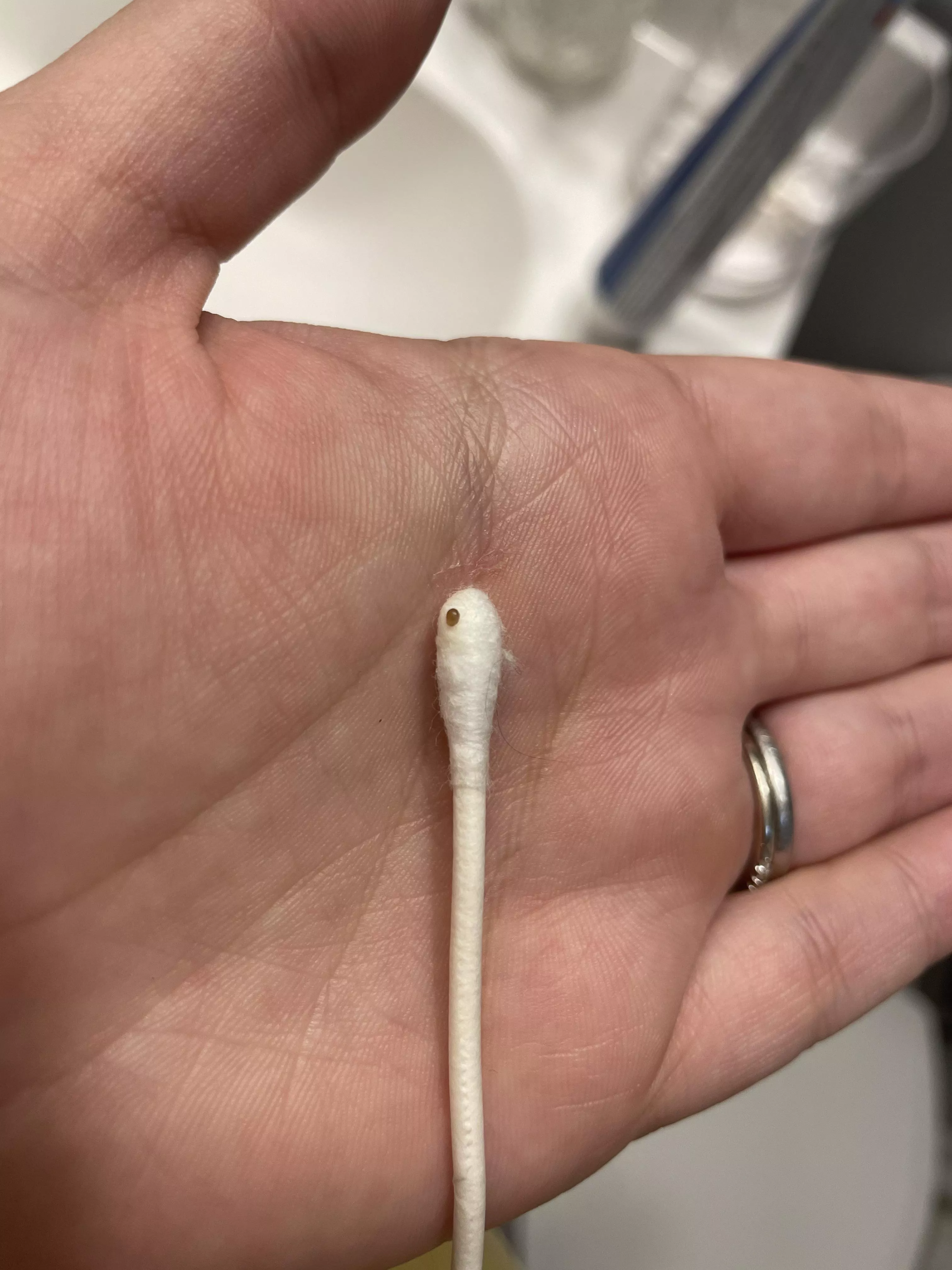 Blackhead from ear. Not the best or biggest but it’s my first post! This was inside my ear and I could feel it with my finger but couldn’t get it out. I finally got it out by using the end of a bobby pin. posted by Time_Address6178