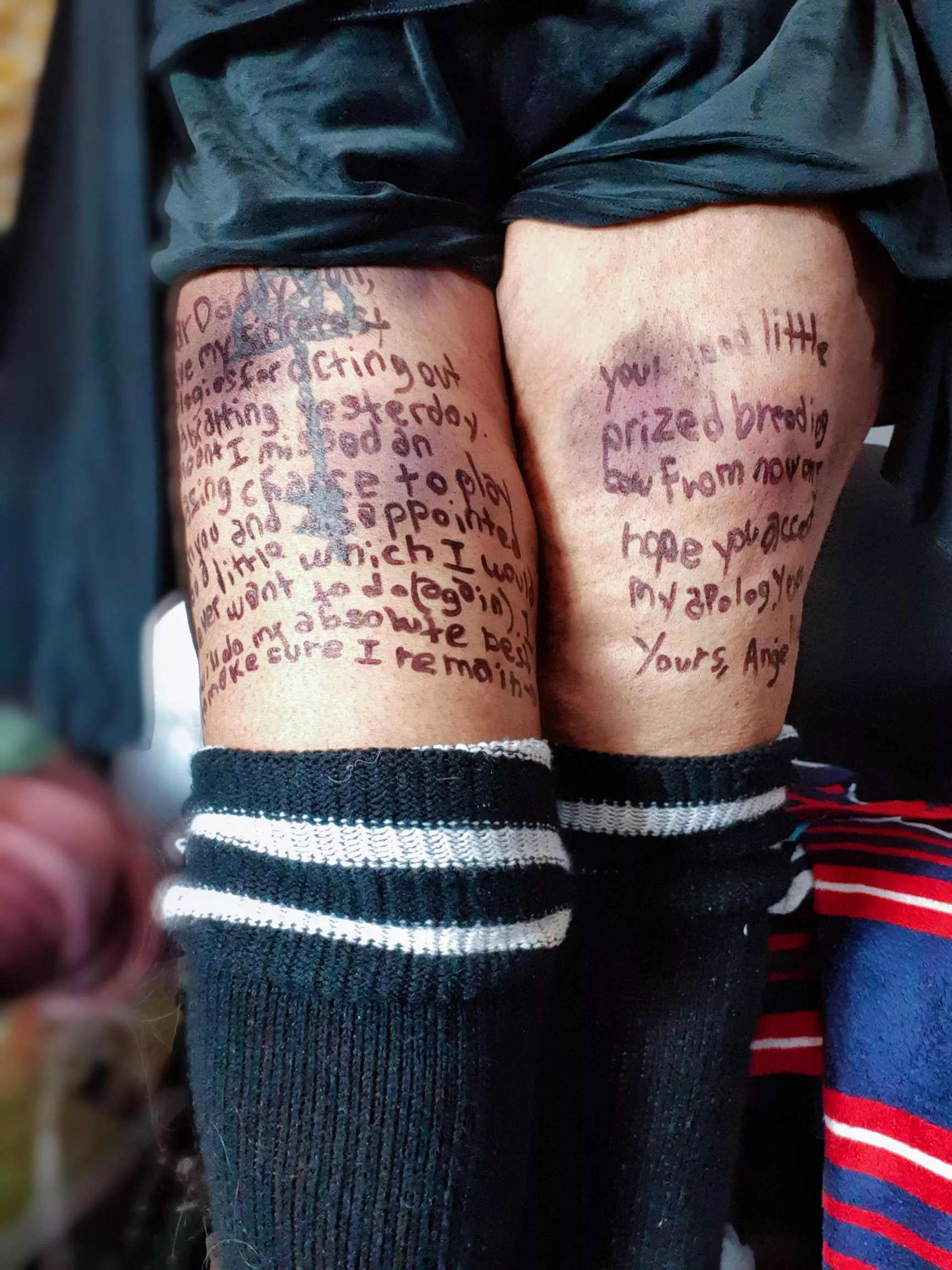 Bruises and body writing go hand in hand ♡ posted by LilBunBunFrouFrou