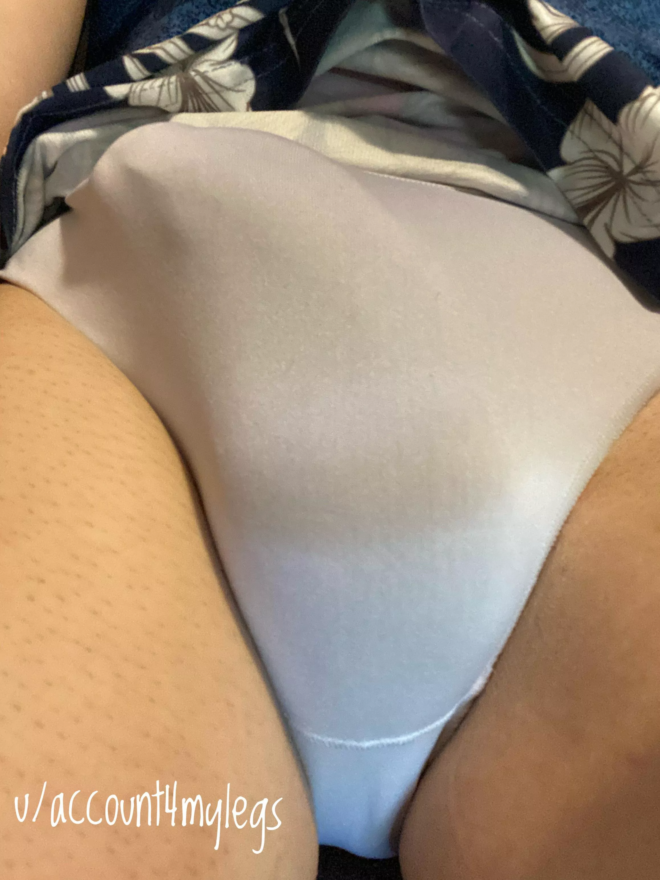 Bulging in white posted by Account4mylegs