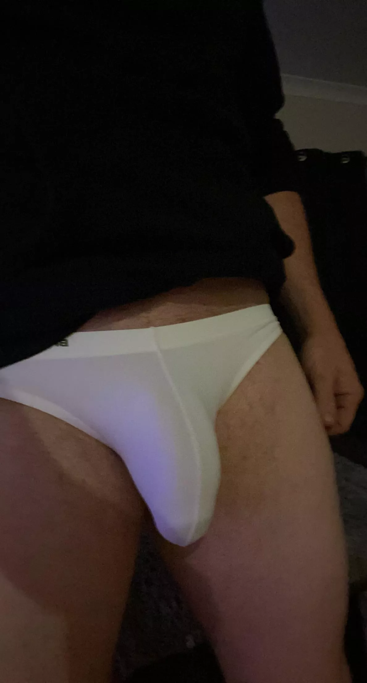 Bulging posted by turbo91p