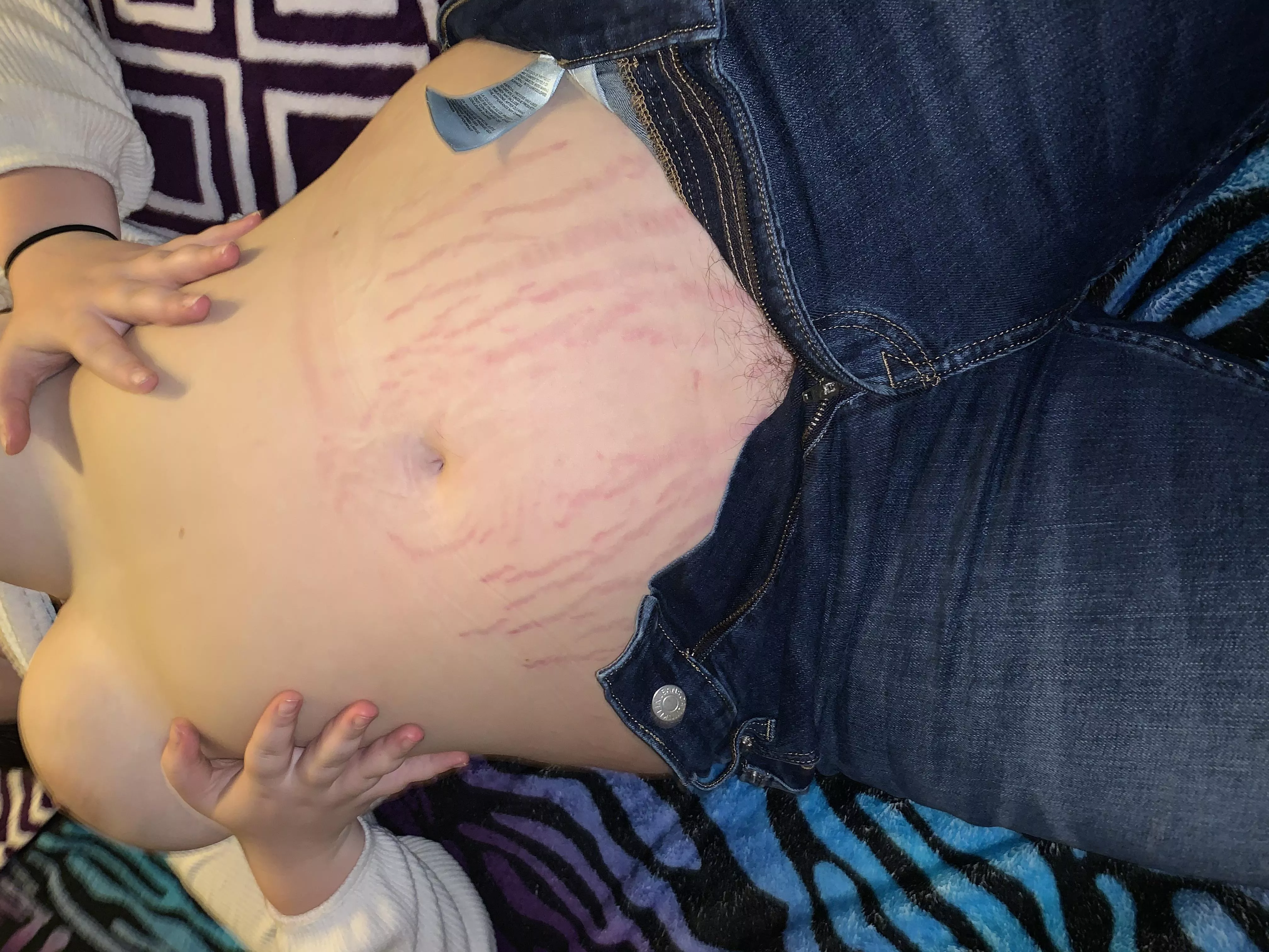 Can a body with stretch marks still be perfect? posted by Lunaisgreat