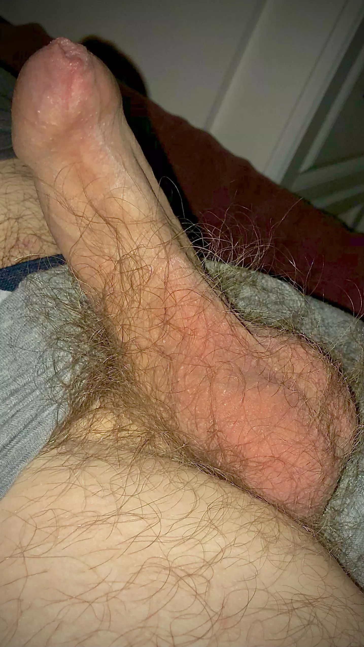 Clean Phimosis Full Foreskin posted by Pure-Invite