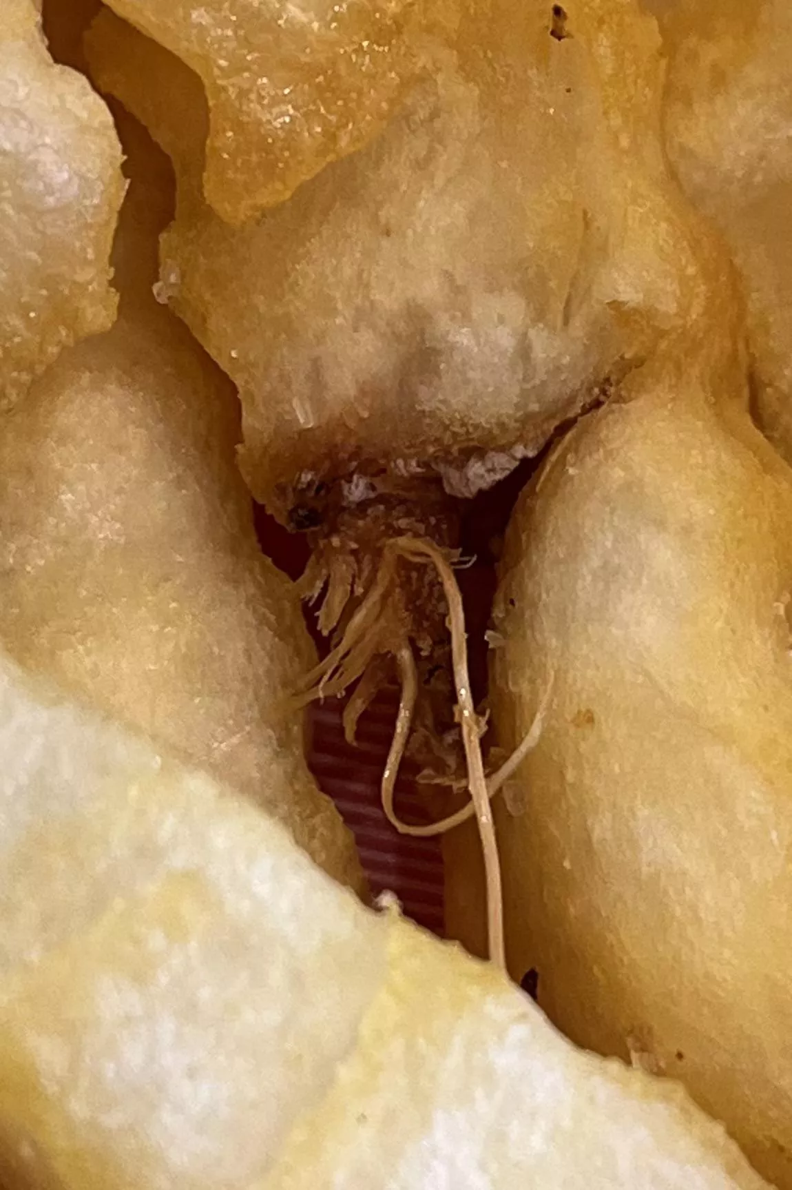 Clump of ingrown hairs (sorry about my dry skin) posted by ollie_ellis92