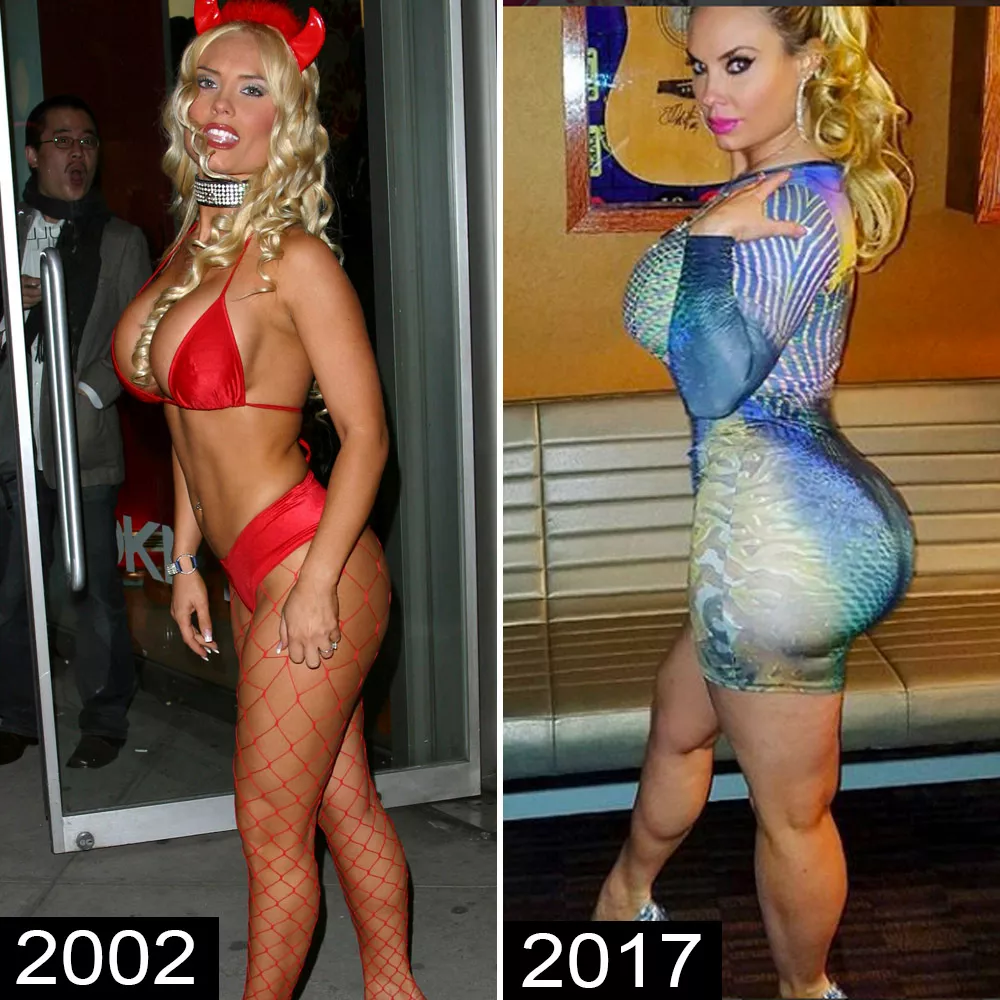 Coco austin butt implants posted by twilightbreakin