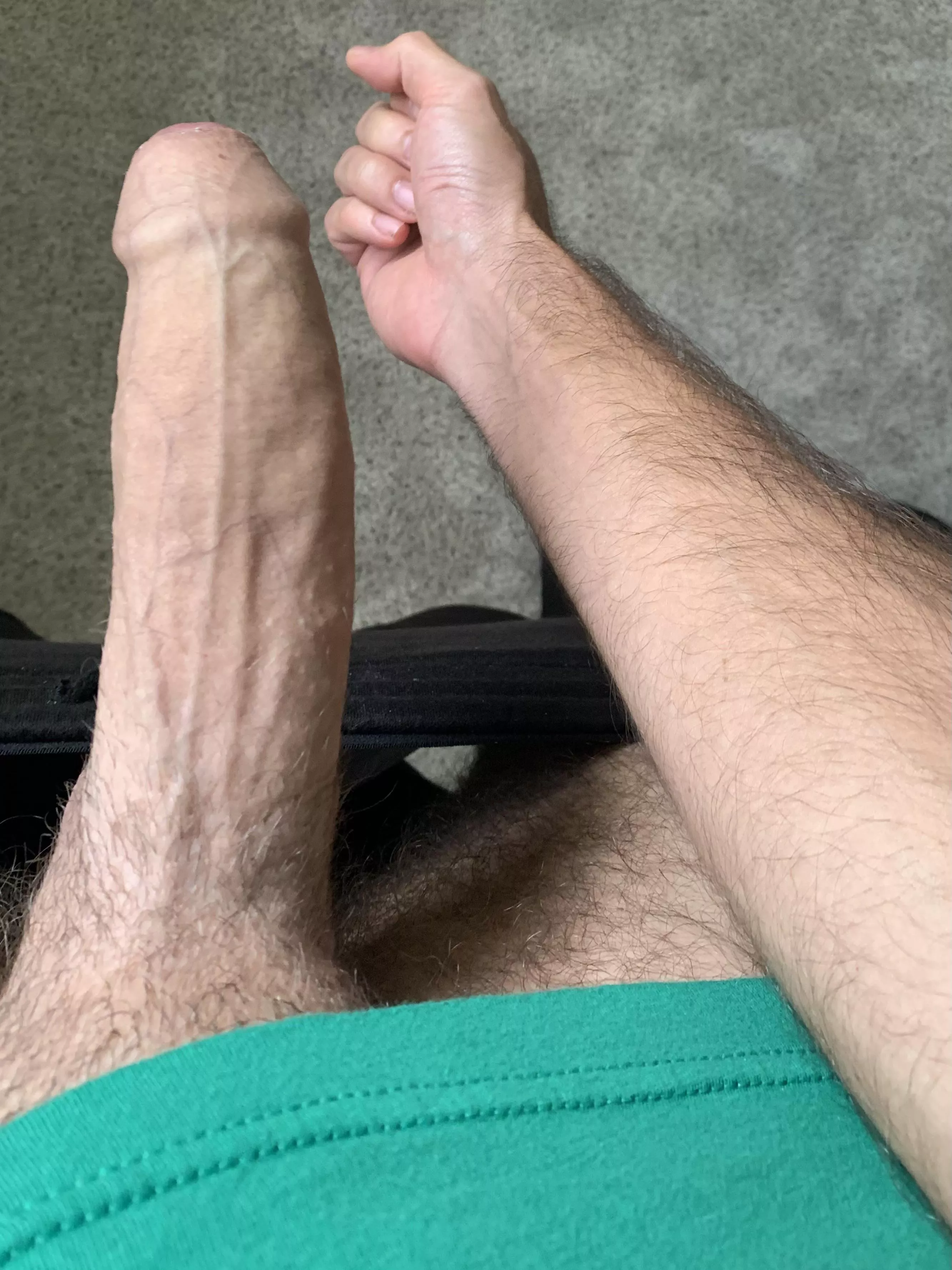 Compared to my other leg 🤭 posted by MenloBull