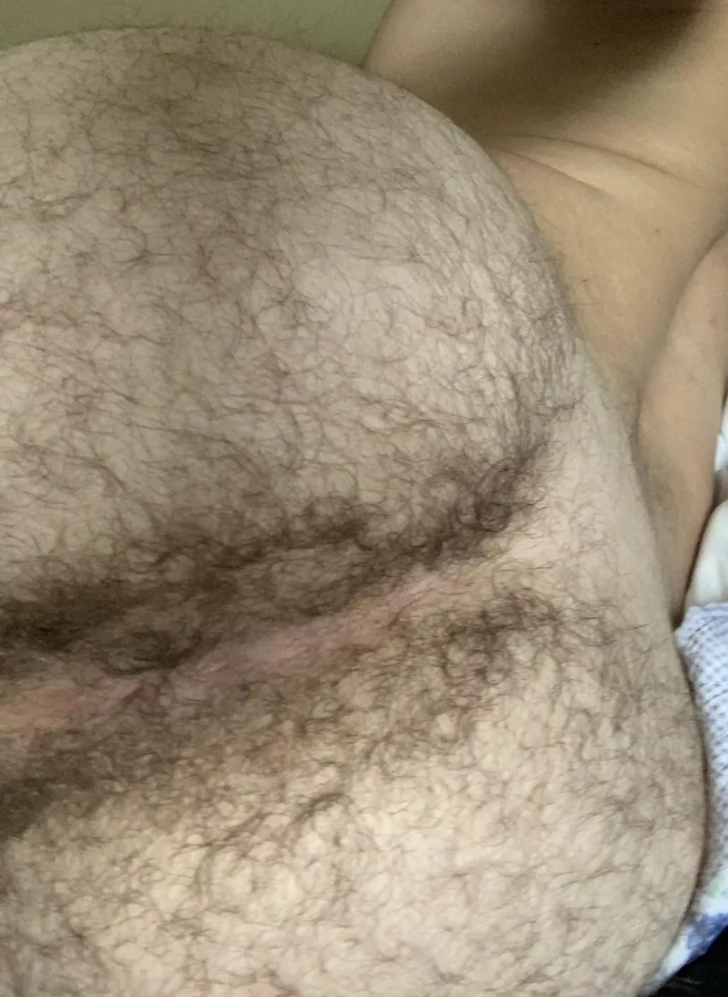 Daddy told me to post my hairy bubble. What do you boys think? Fuckable?? posted by bubblebuttmarried26