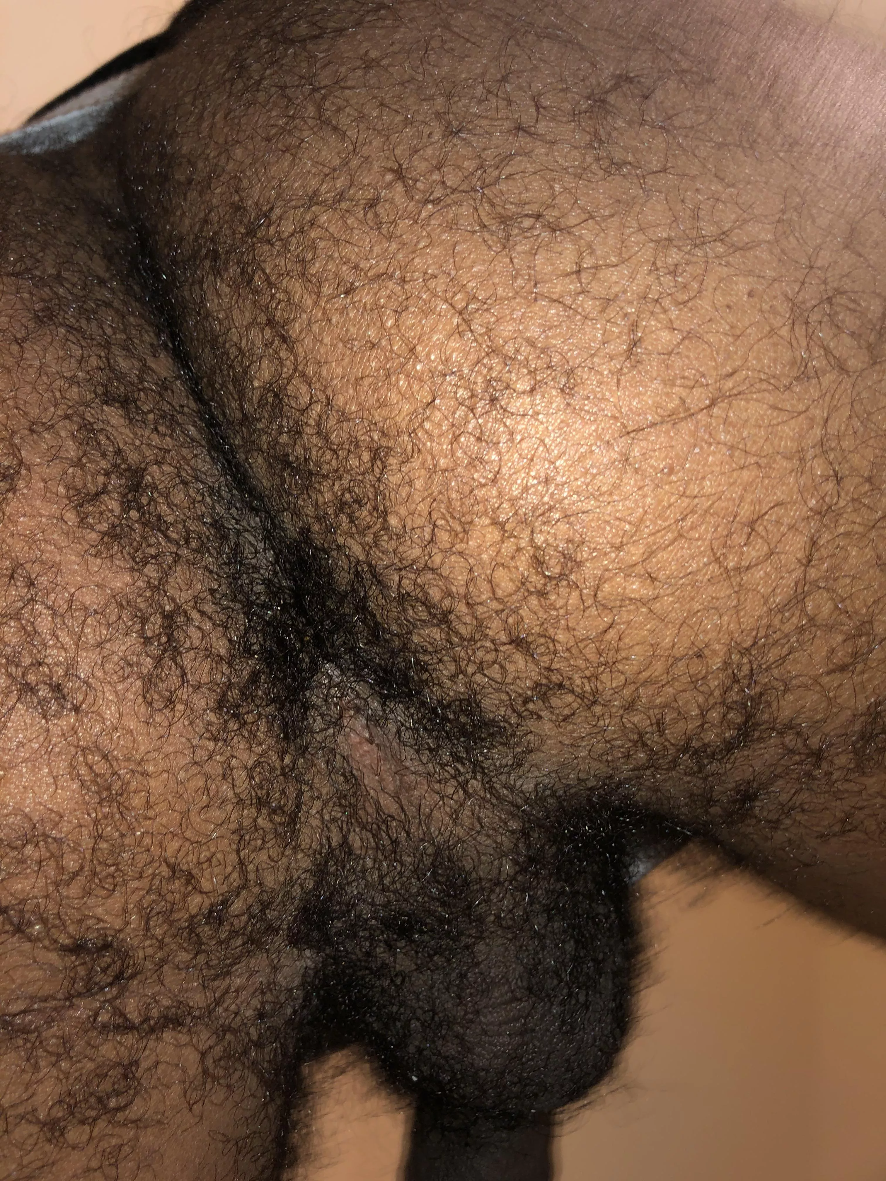 Do you like em hairy and clean? 🌸 posted by theon-e_chicago