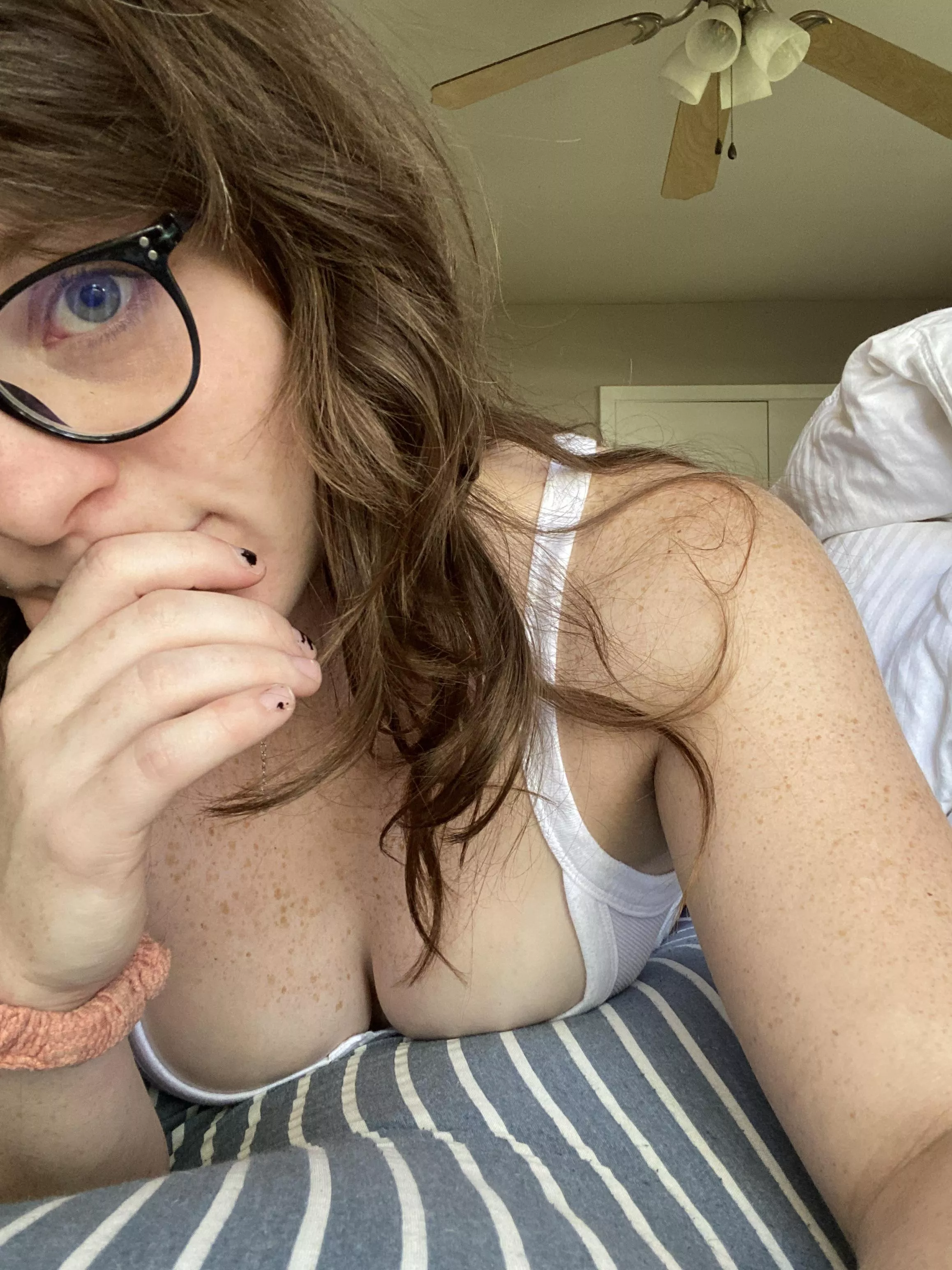 Do you like freckles? [f] posted by freckledspirit