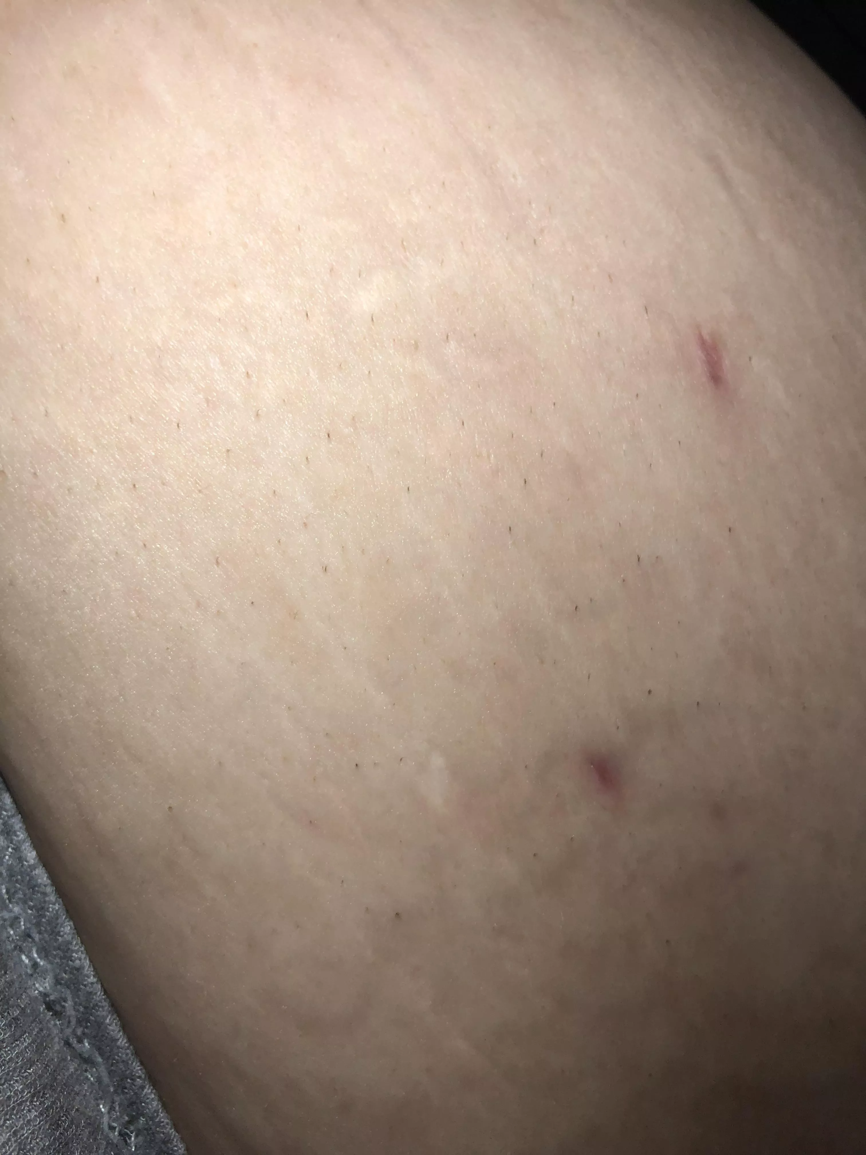 Does anyone know what these little hairs are? They don’t hurt to pluck and come out super easy. They’re on my sides and stomach occasionally. Worse on my sides though. posted by kcottrill95