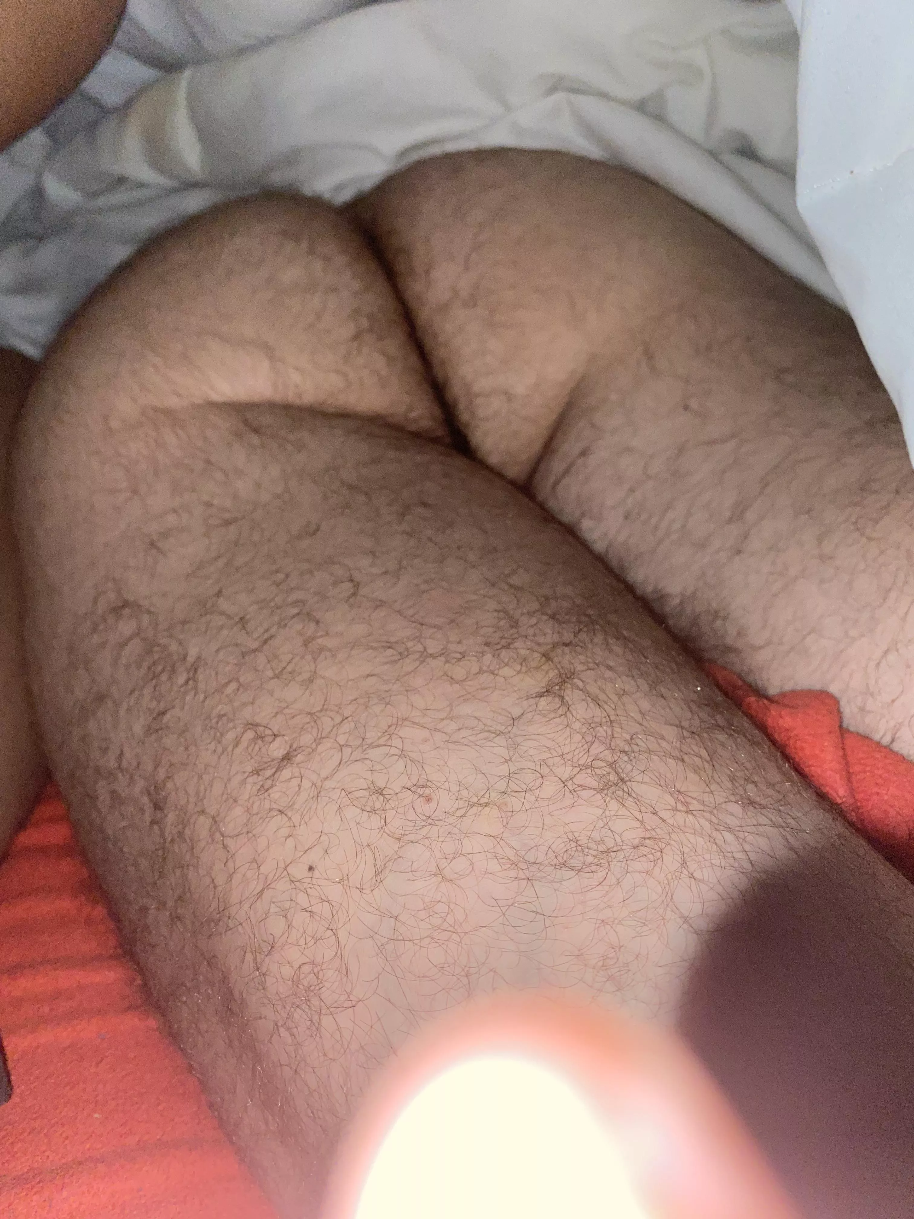 Does this look like a hairy man’s 🍑? posted by PeachCrocodile2