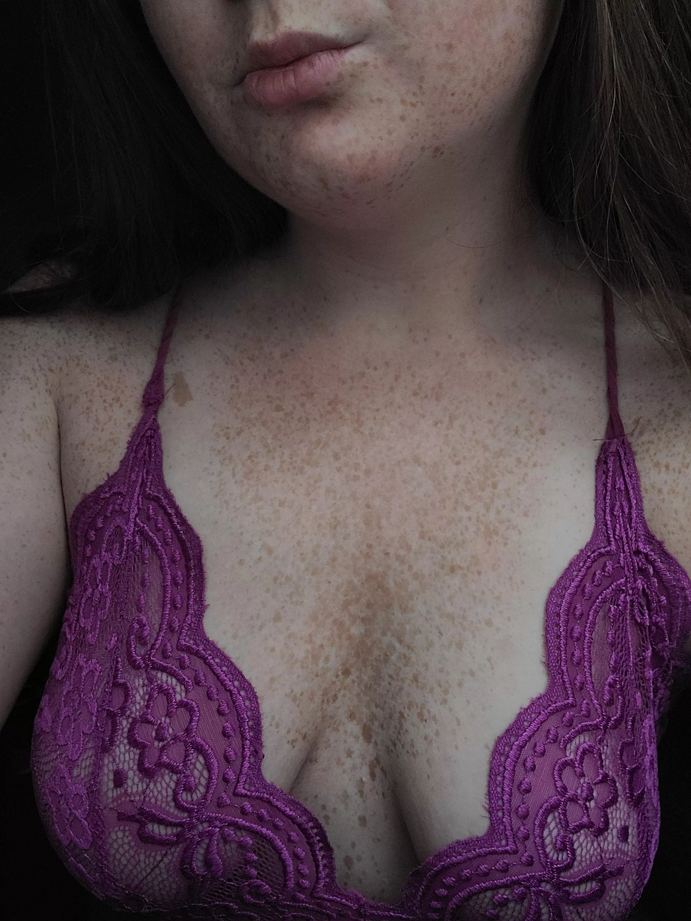 each freckle is a soul stolen posted by freckledxxfreak