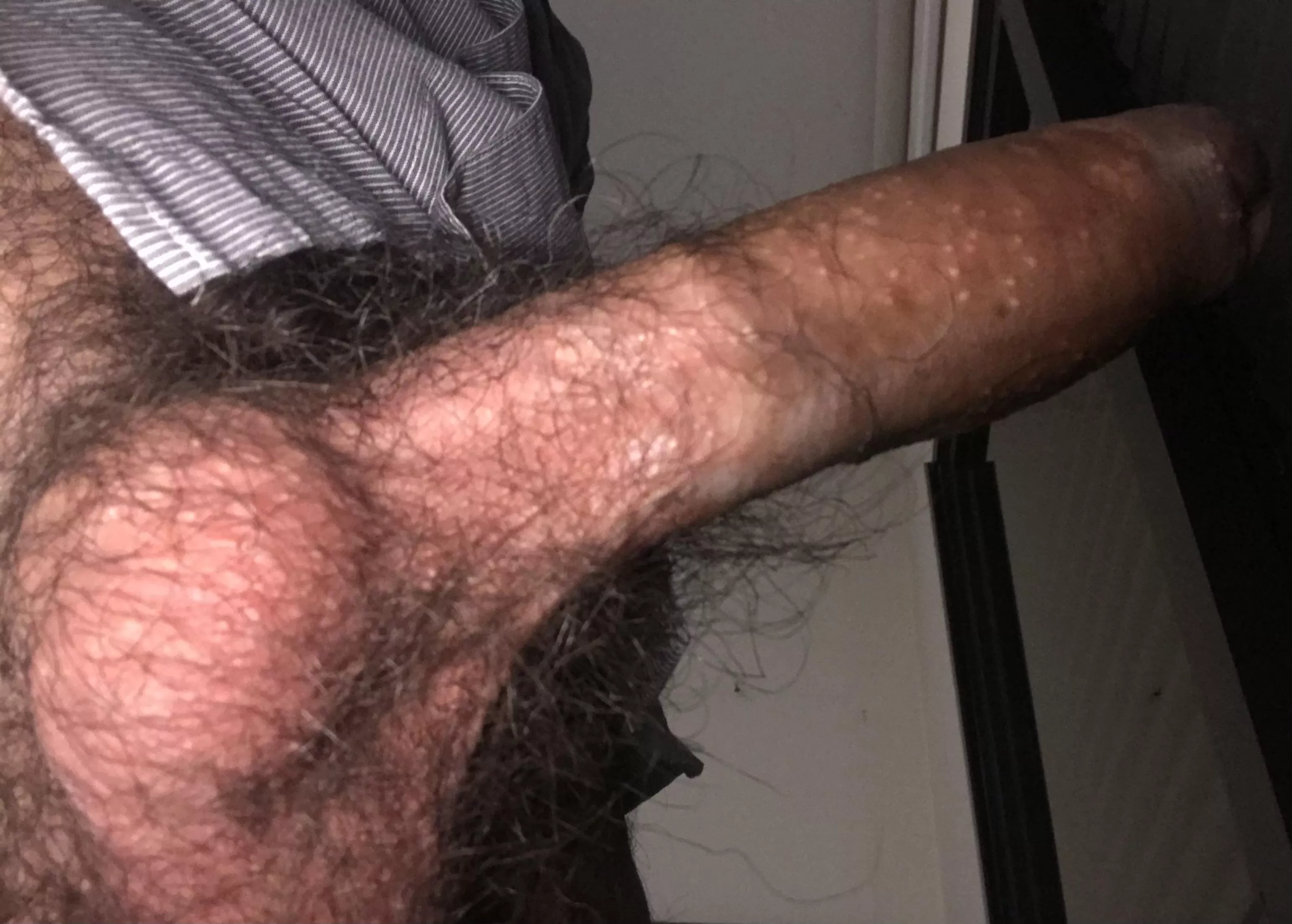 Erect & hairy! posted by sminty2000