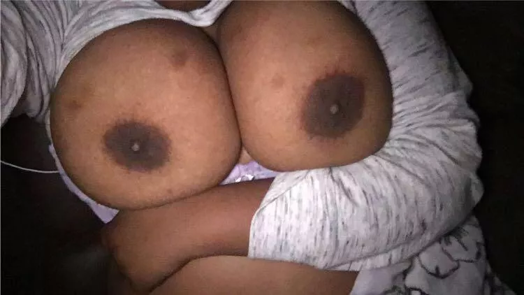 Excuse the hickies but rate my breasts 34DDD posted by Bigbadbunny_