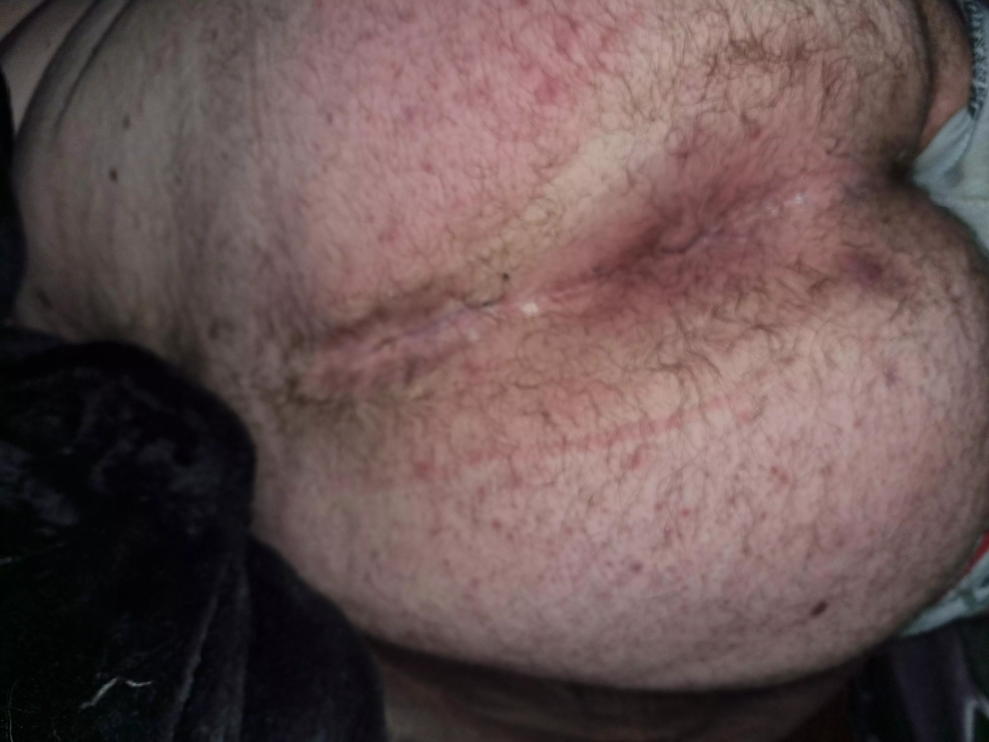 First pic of my pussy posted by DaddyBear1994