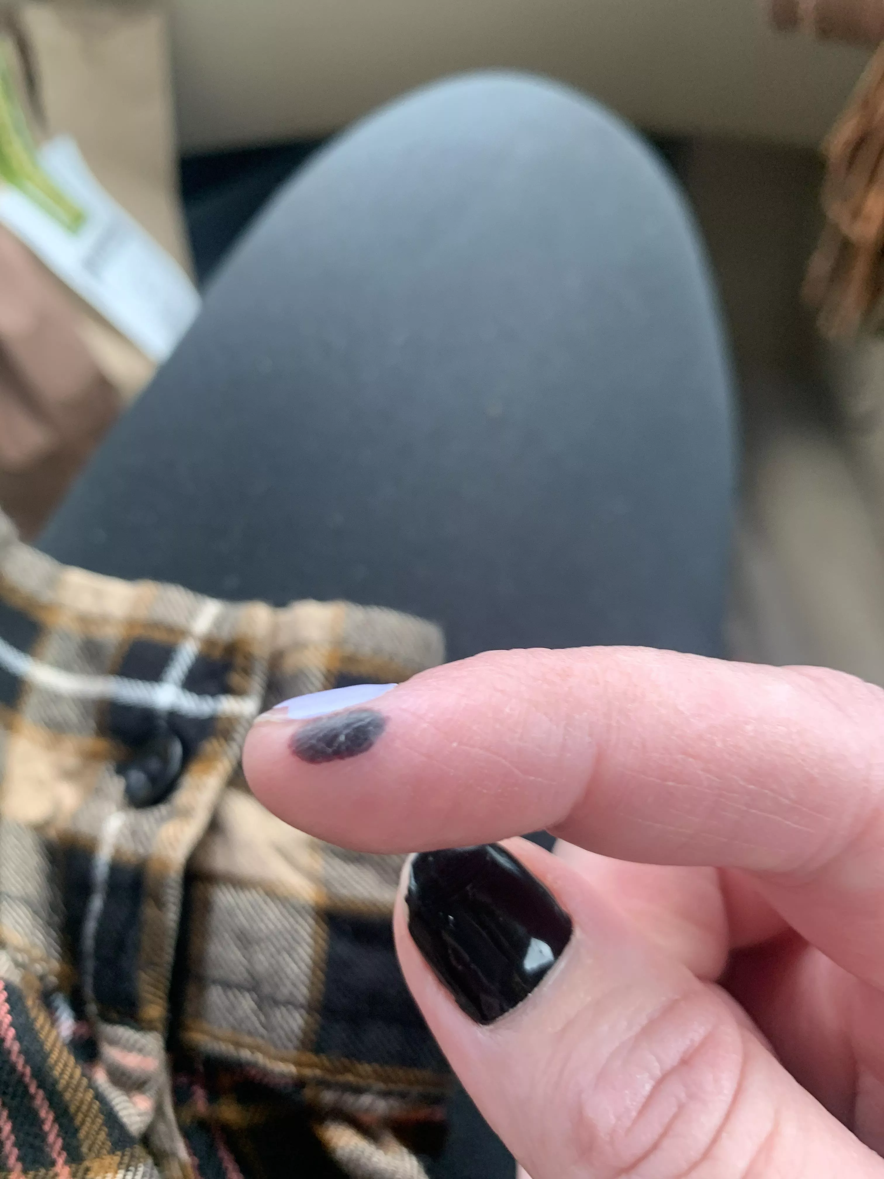 Forbidden pop. Blood blister. Quite dark. posted by LezbihonestPlz