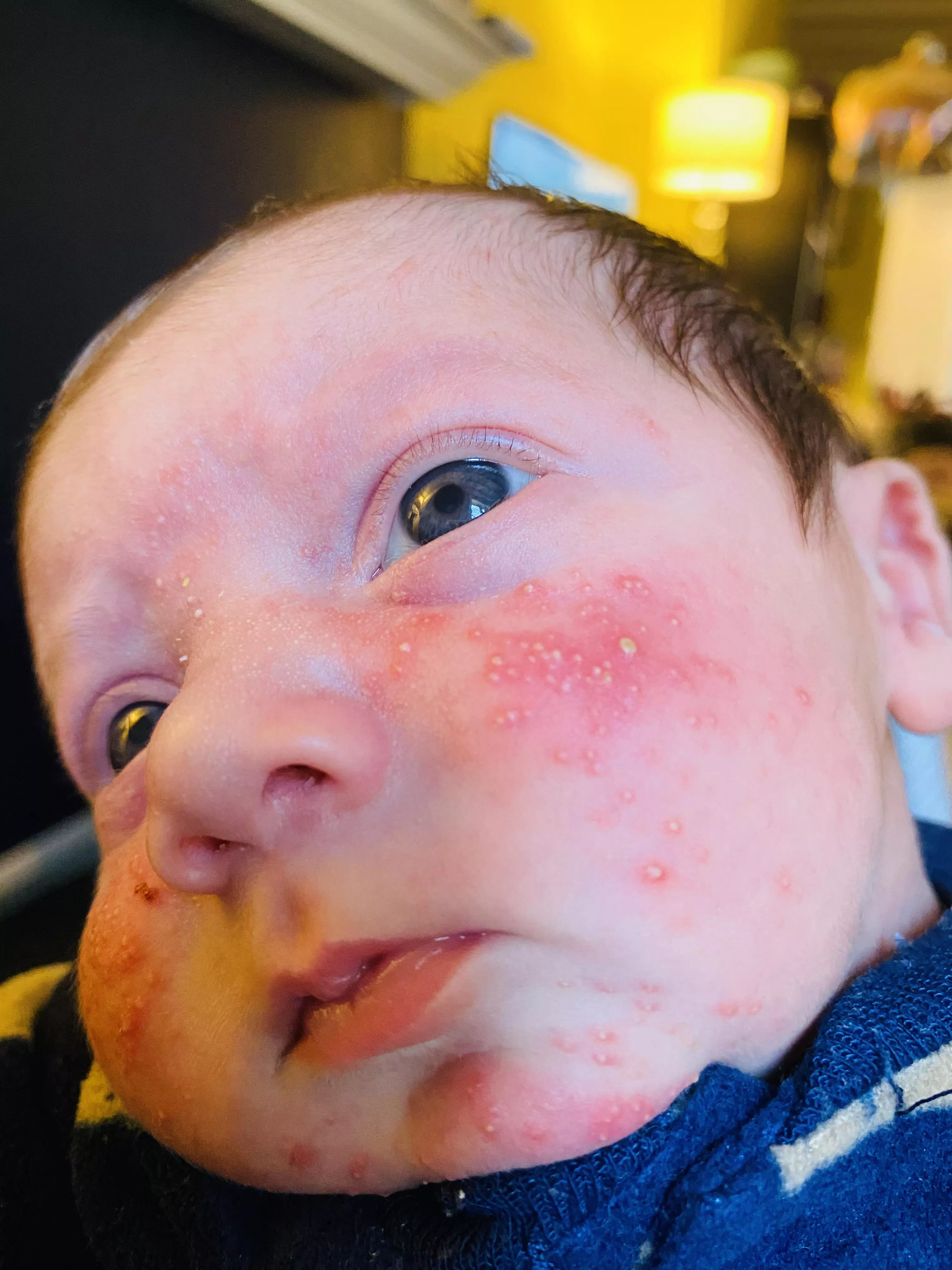 Forbidden Pops on my 2 week old boy! posted by JTmarry2018