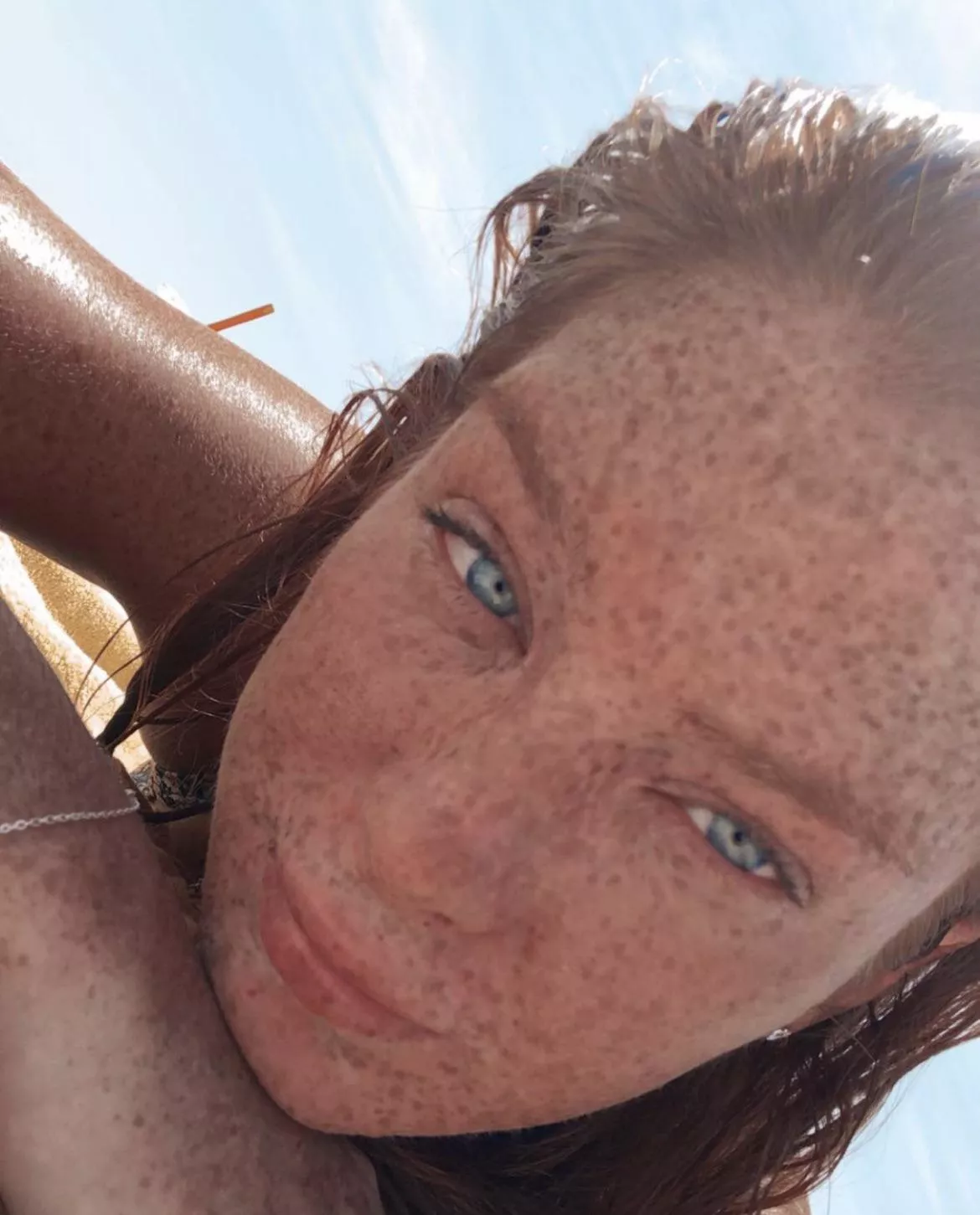 Freckle Face posted by perfidium2020