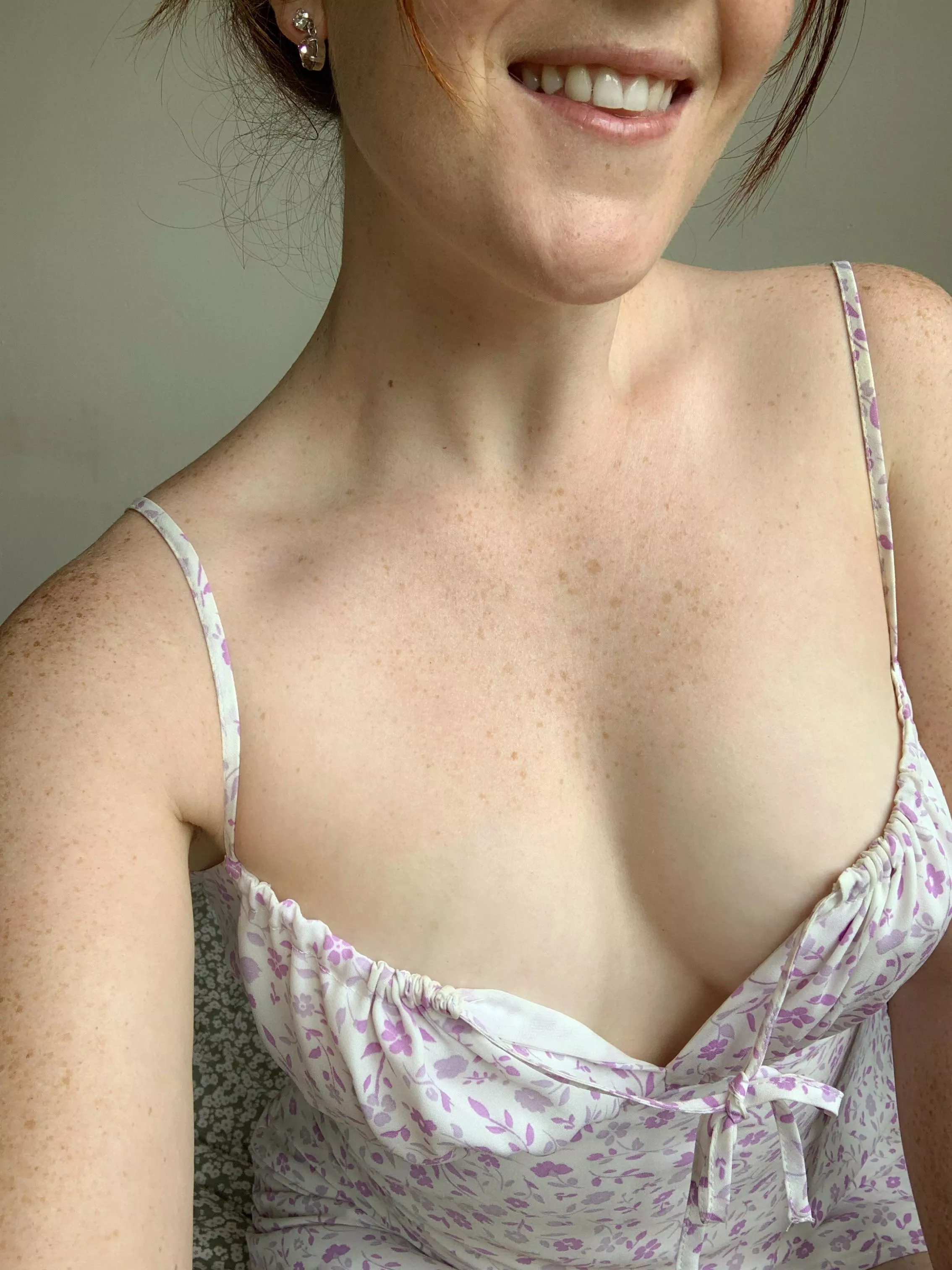 Freckles on the chest a big yes or a big no? F26 posted by sweetredcolette