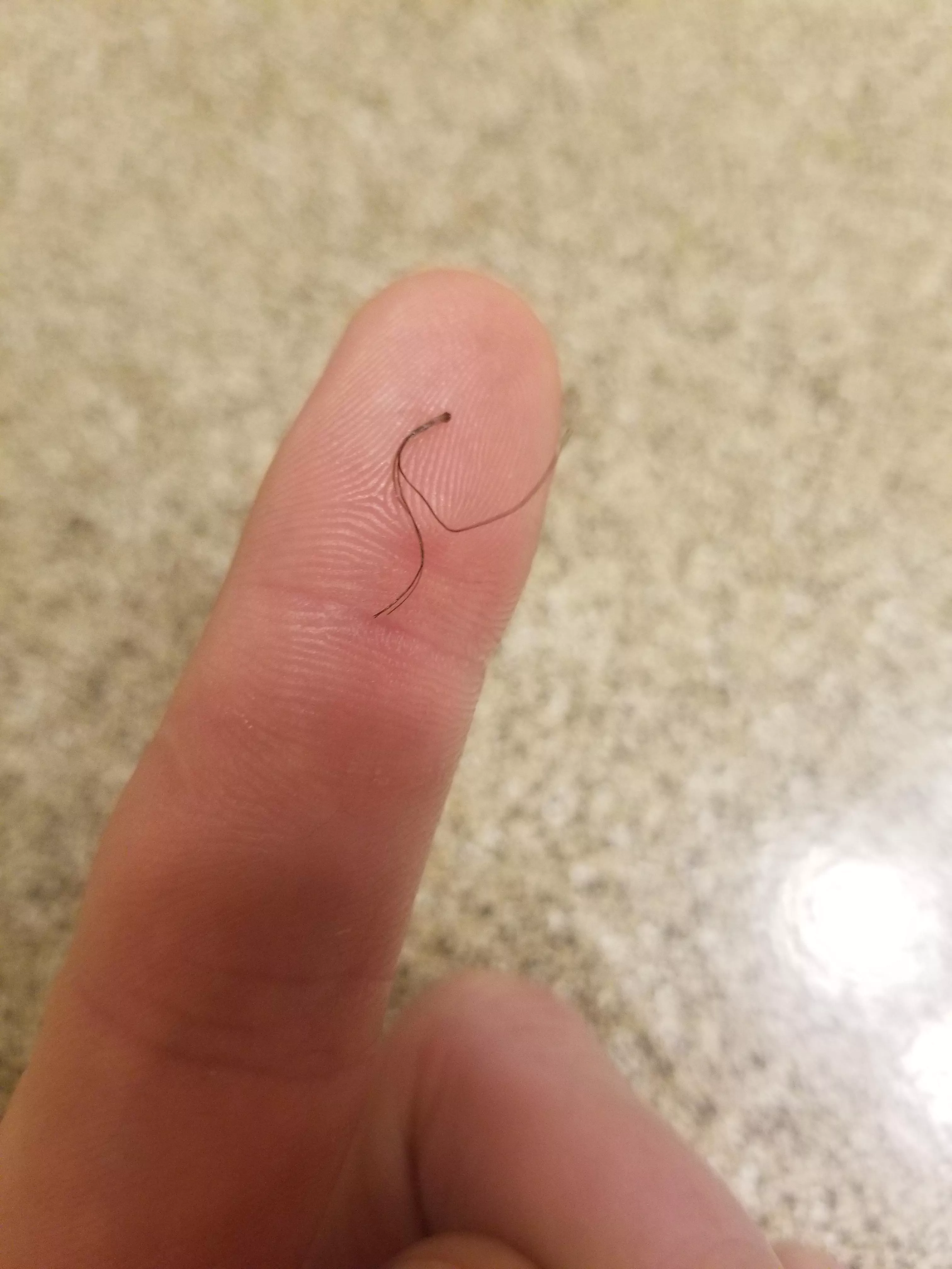 Funky beard hair. Not really ingrown but still cool. posted by rrppdd4