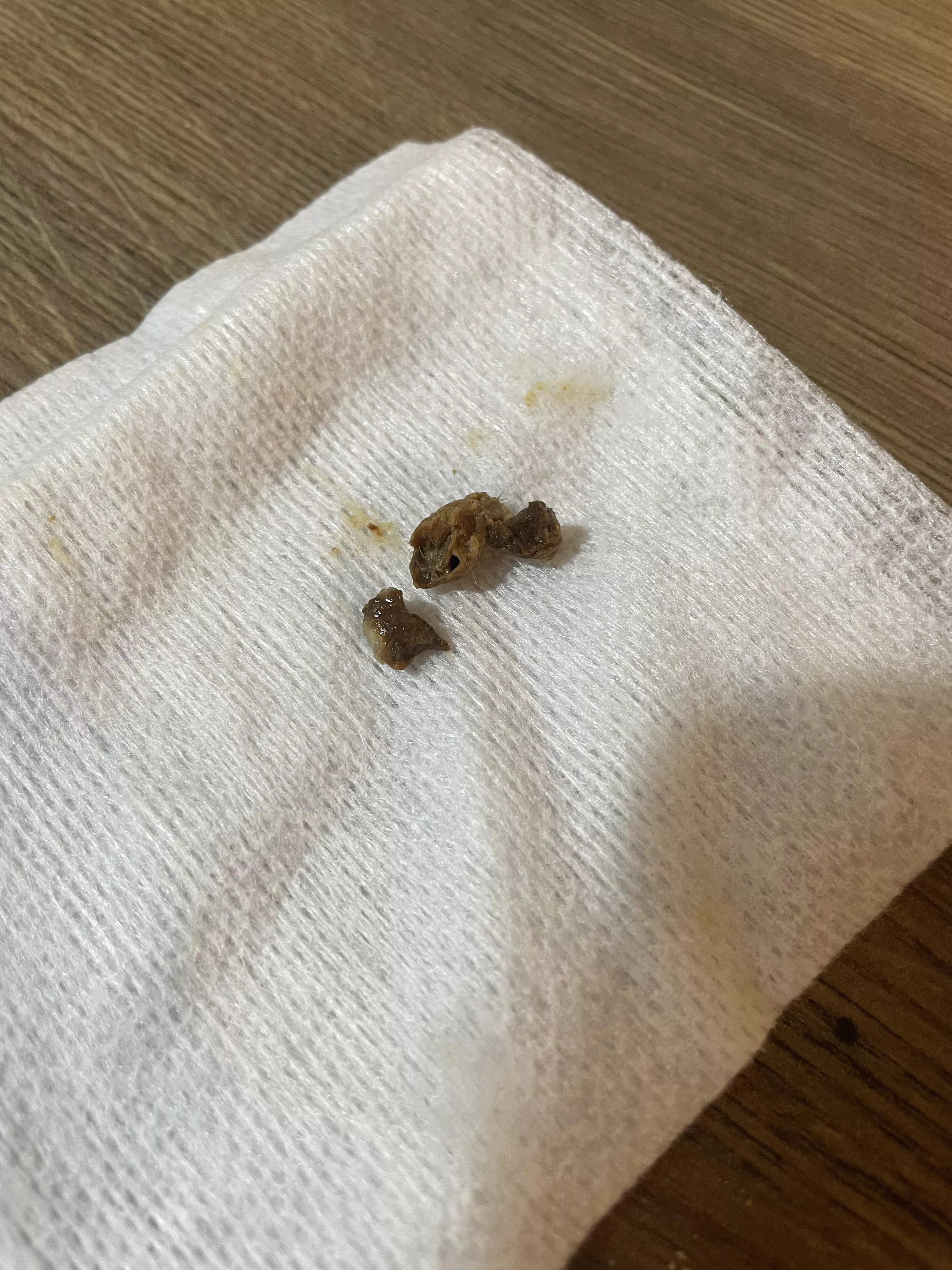 Giant glob of earwax extracted from my mums early. She was almost completely deaf before extraction posted by aridddd