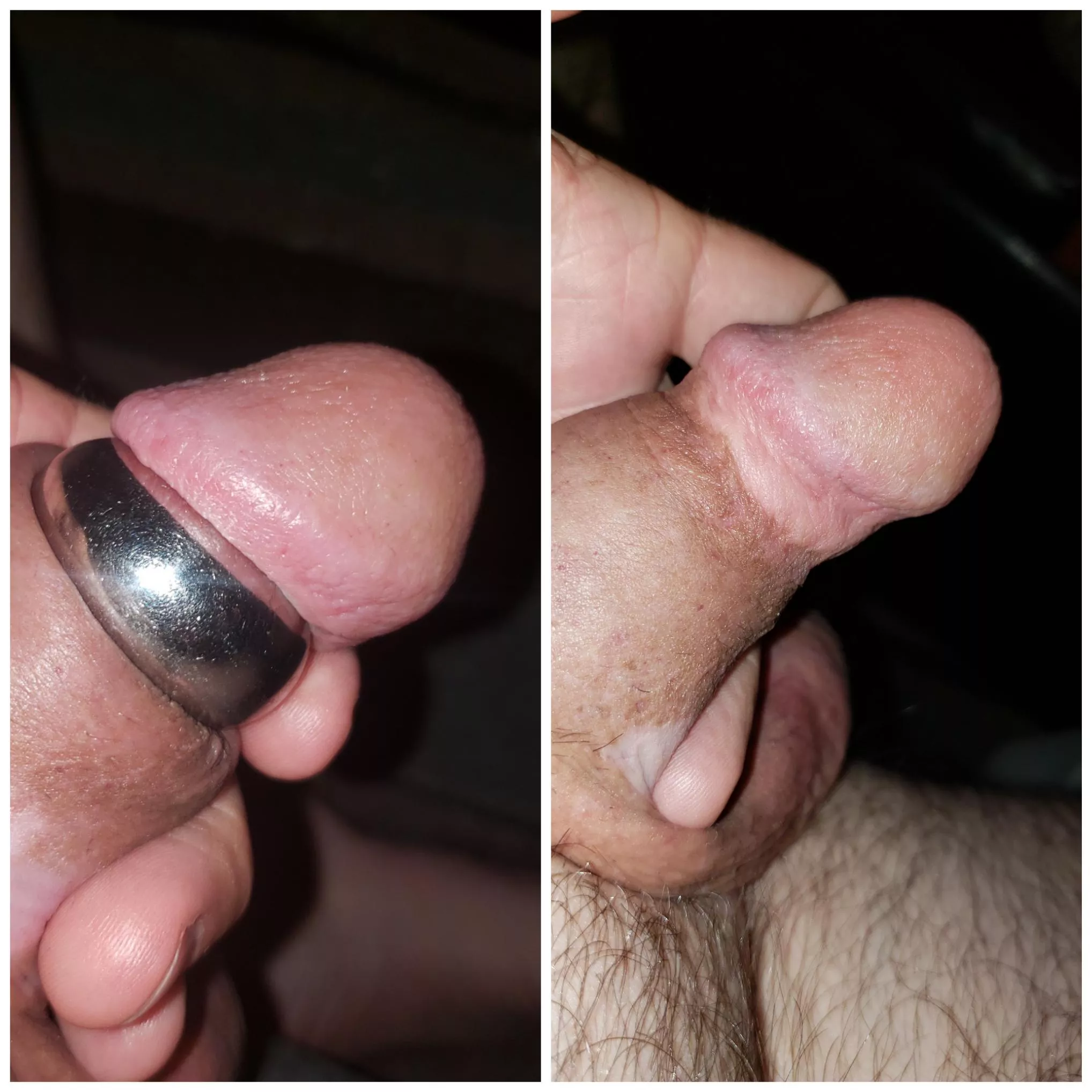 Glans ring and pumped posted by gilfkindofman