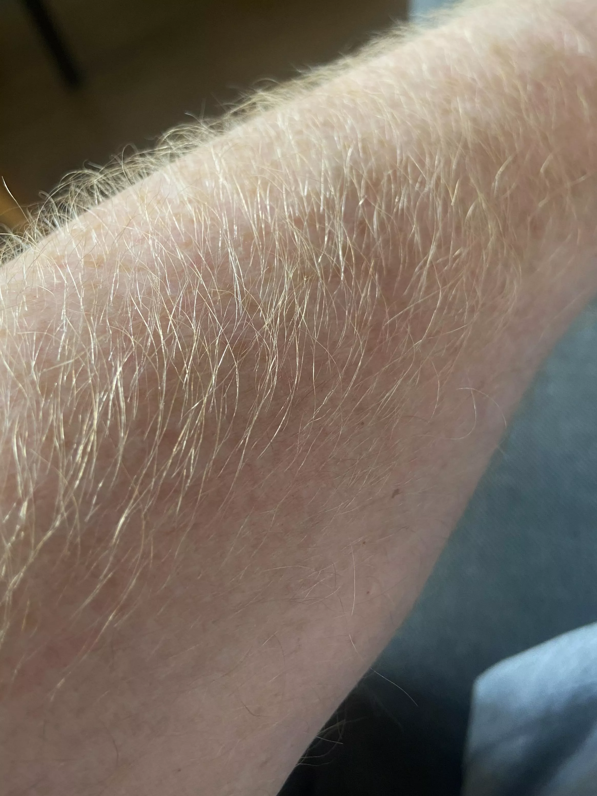 Good morning, hereâ€™s my ginger forearm for ya. posted by freeballfootyshorts