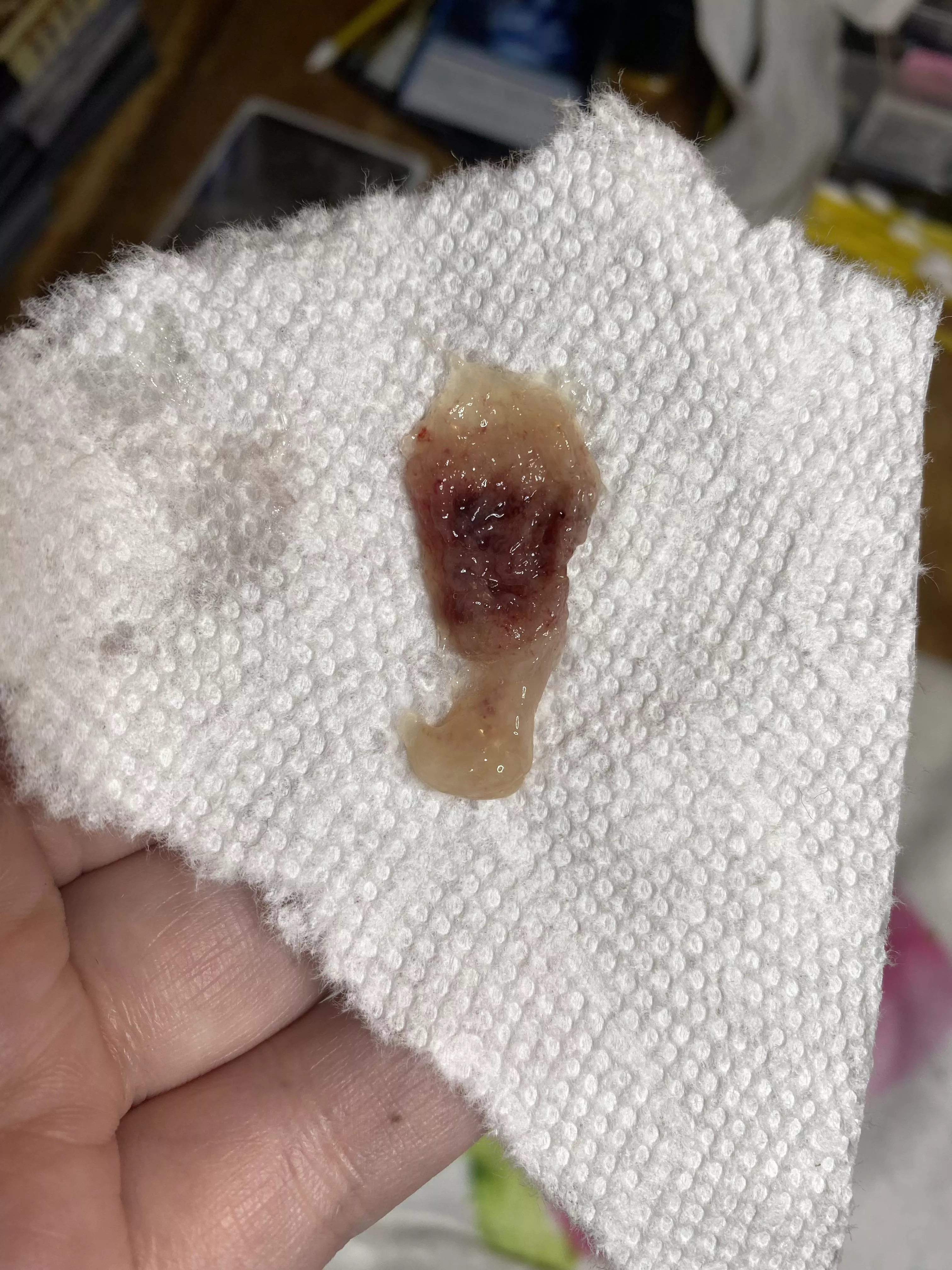 Got the Rona and good god, this god awful thing was stuck in my nasal passages for 4 days. Got it out today and I could finally breath! posted by ShinnyCrab