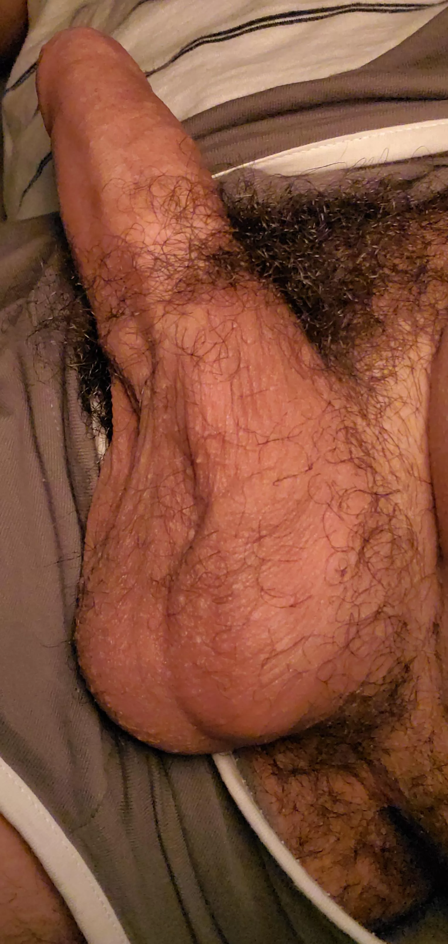 Hairy enough? posted by Humble_Tiger_1519