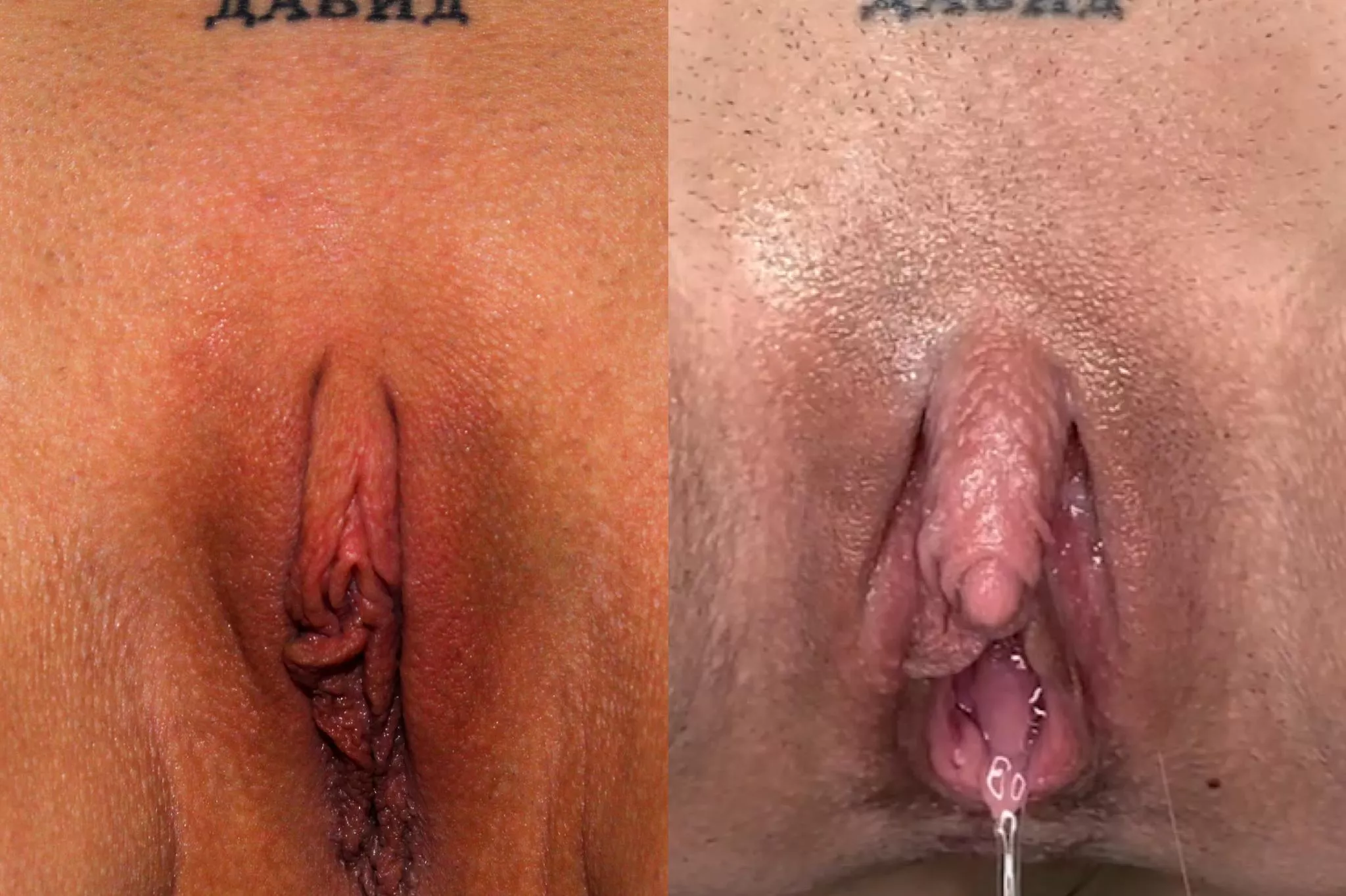 I always love sharing before & after pics of my big clit enlargement. Look how far Iâ€™ve cum! ðŸ¤¤ðŸ˜ˆ posted by theeuroslut