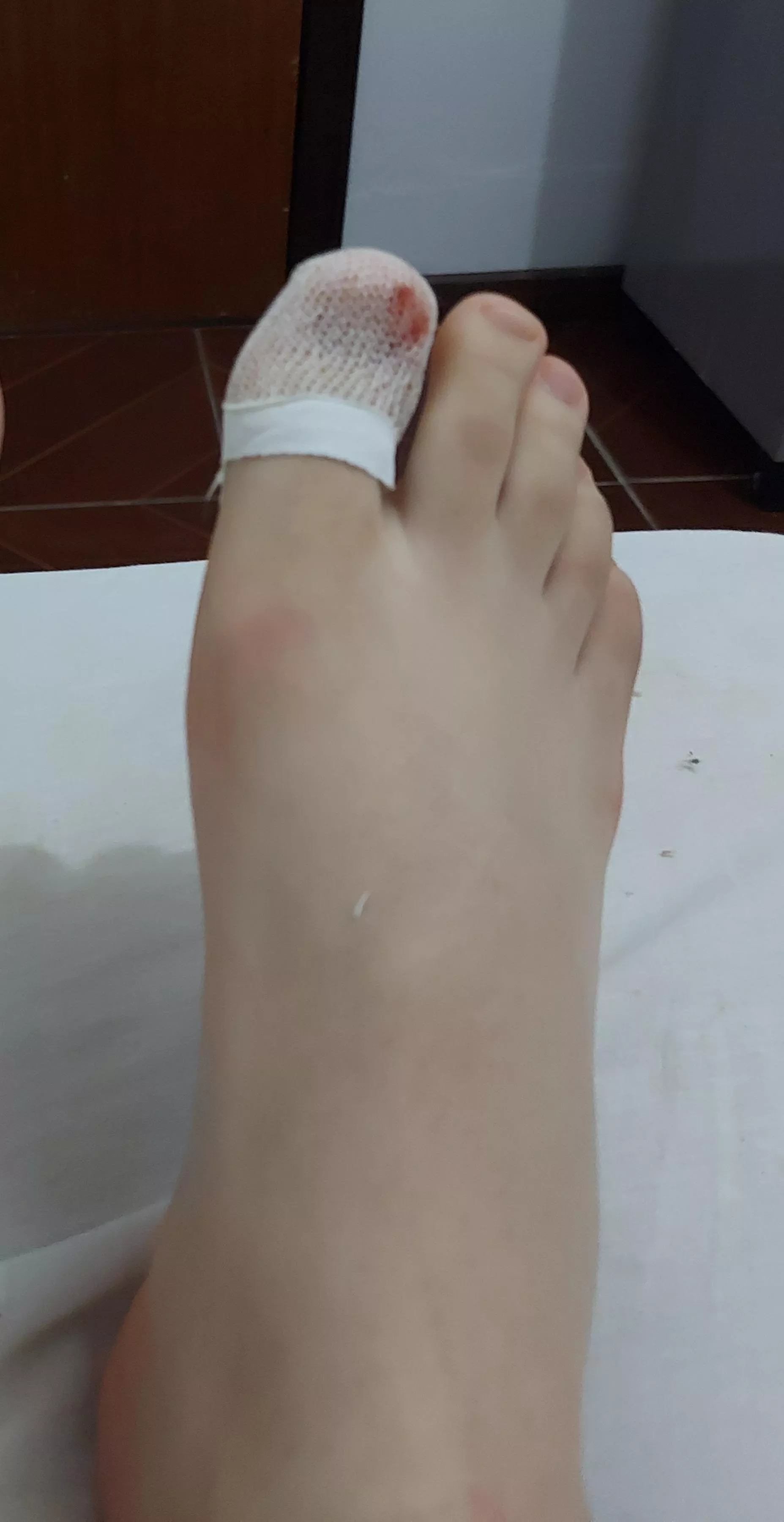 I hurt my toe 🥺🥺 can someone take care of it for me [19] posted by LukeCinnabun