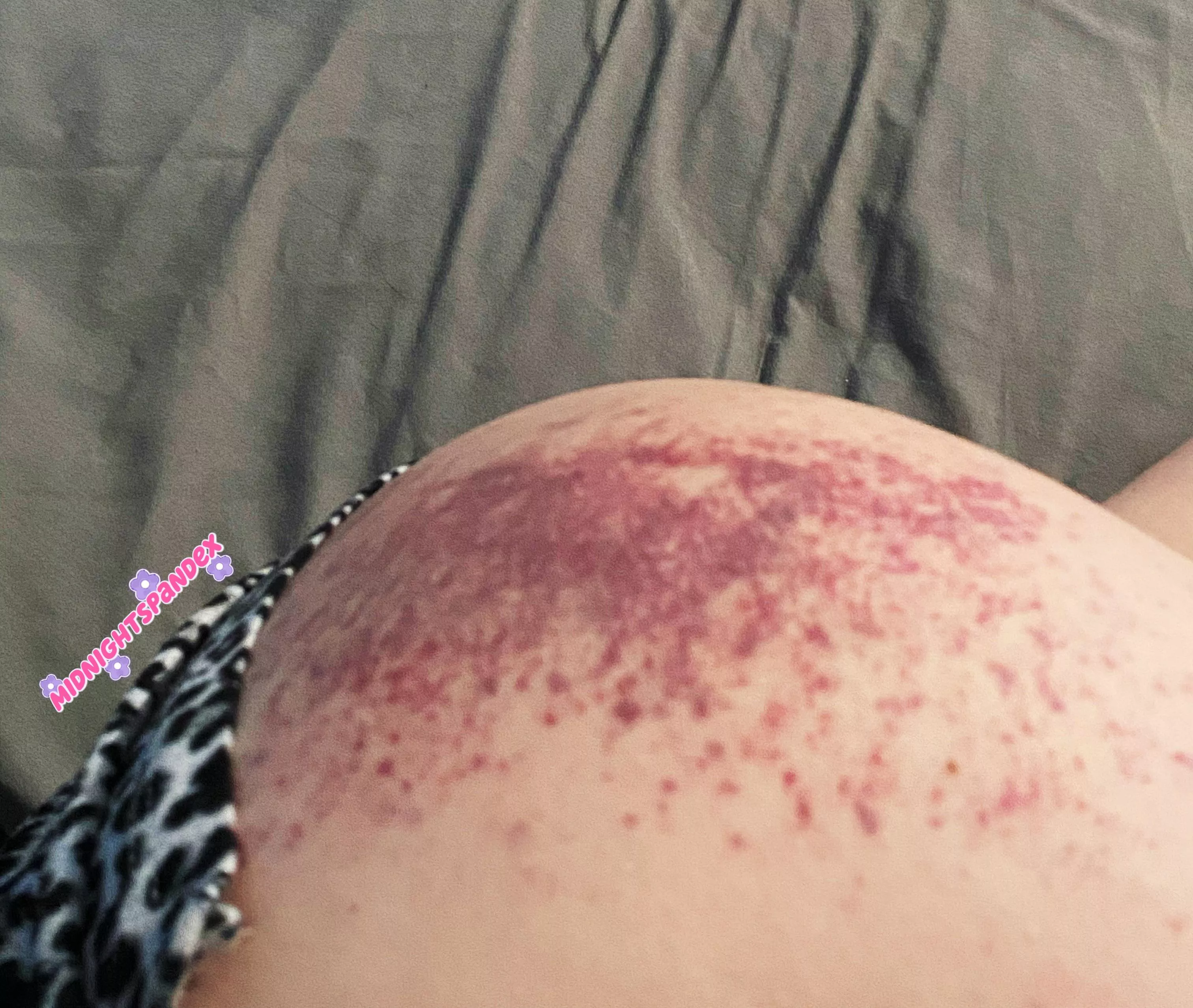 🙈💕I just kept asking my Dom for more (spanking aftermath), 25F posted by Peachiis_Pit96