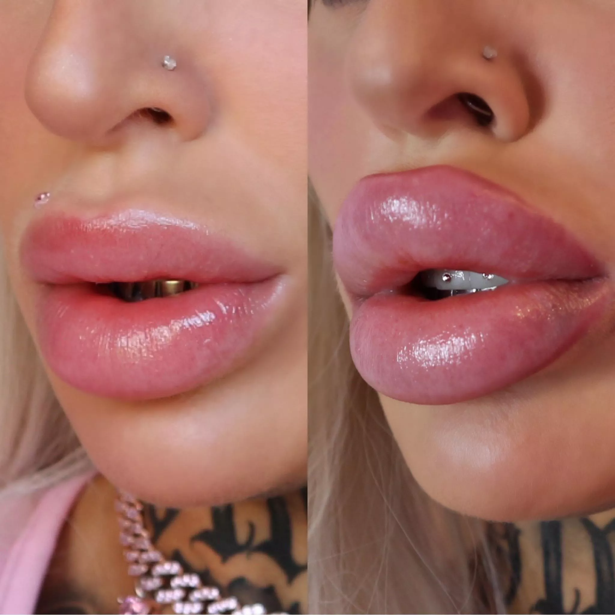 I love transforming into a plastic Bimbo f*ck doll! DSL progress - we did 3ml top up 💉💕 posted by Alicia_amira